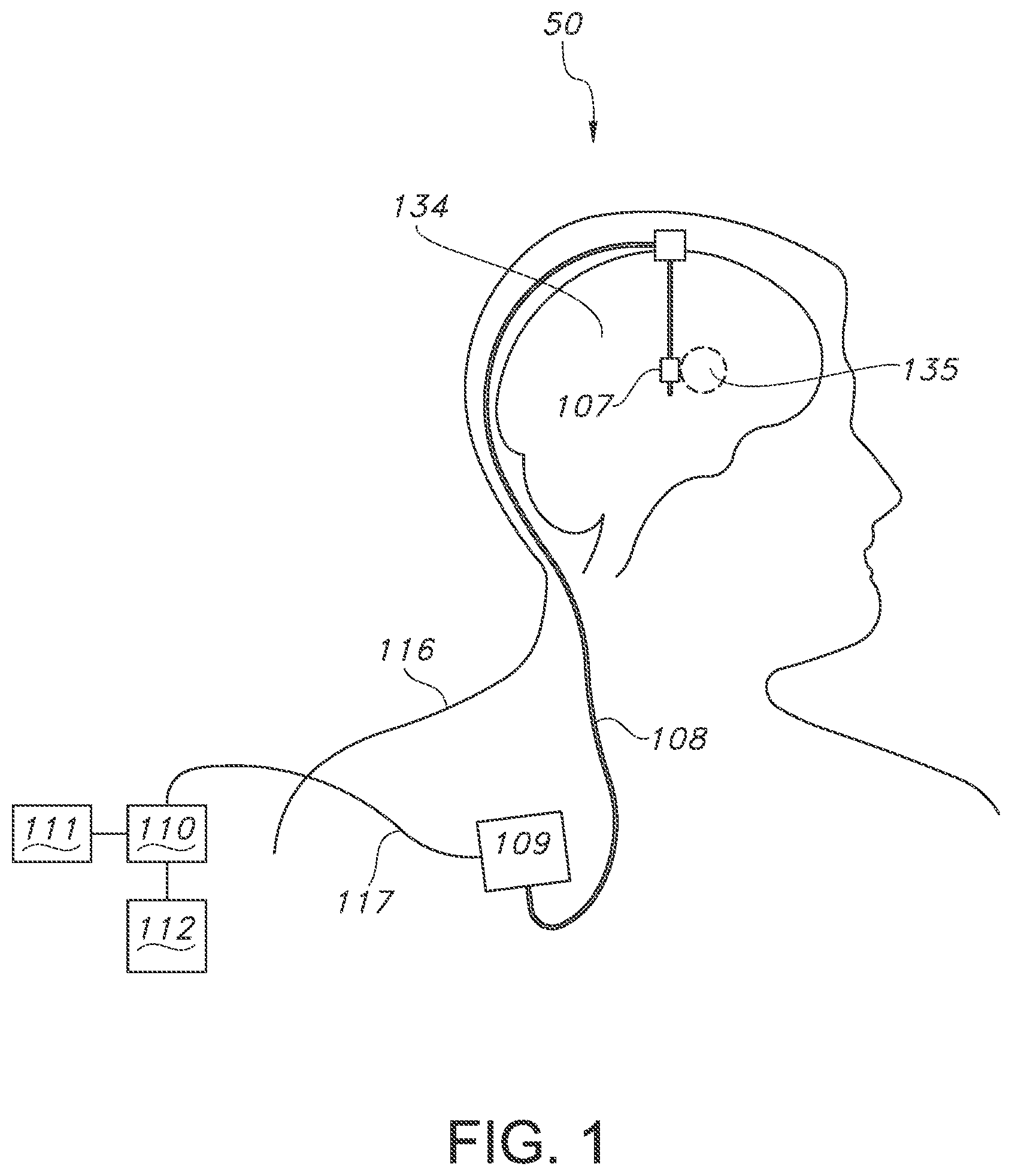 Patent US11793443 — Adjustable random electrical stimulation technologies — Figure 1