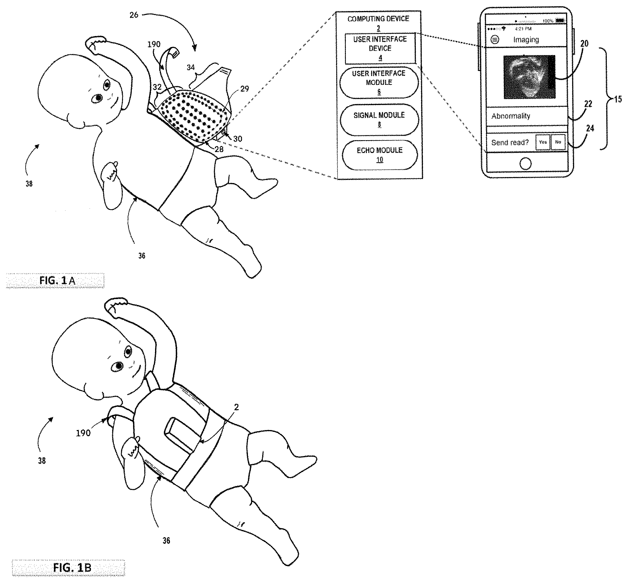 Patent US11793487 — Transducer array device, method and system for cardiac conditions — Figure 1