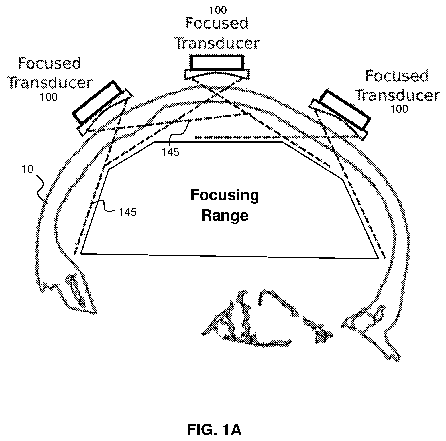 Patent US11793490 Figure 1 – Systems and methods for performing transcranial ultrasound therapeutic and imaging procedures
