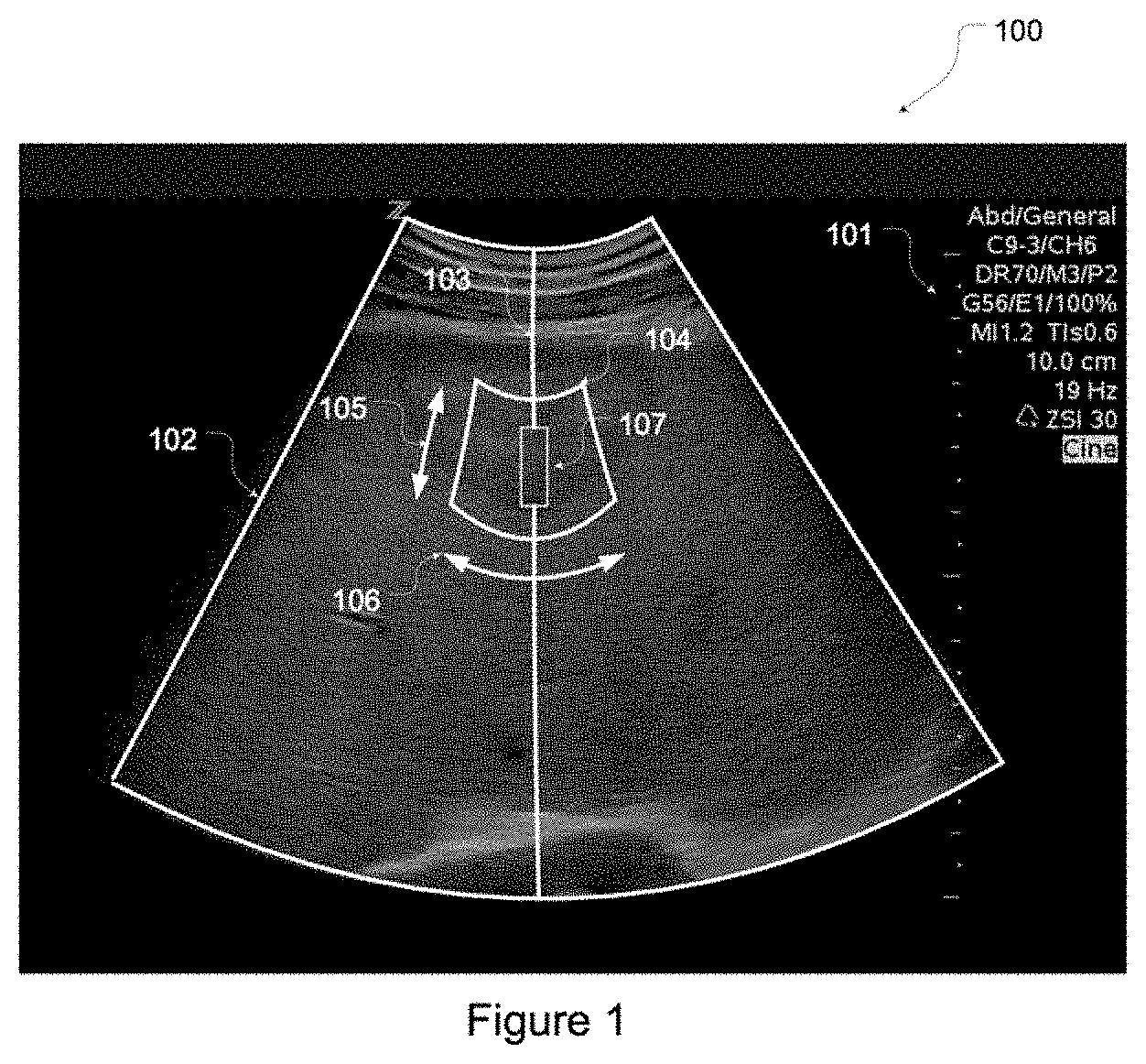 Patent US11793491 — Predictive use of quantitative imaging — Figure 1