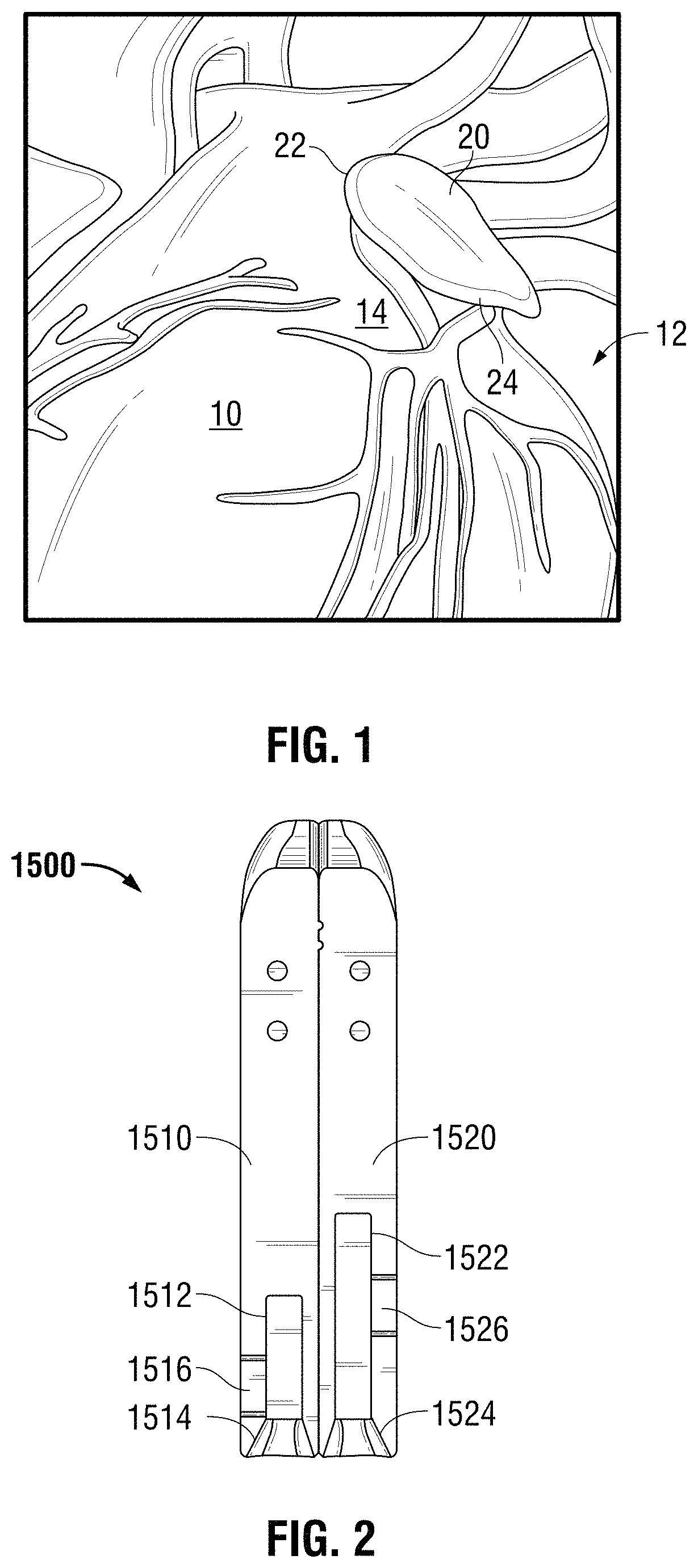 Patent US11793524 — Recapturable left atrial appendage clipping device and methods for recapturing a left atrial appendage clip — Figure 1