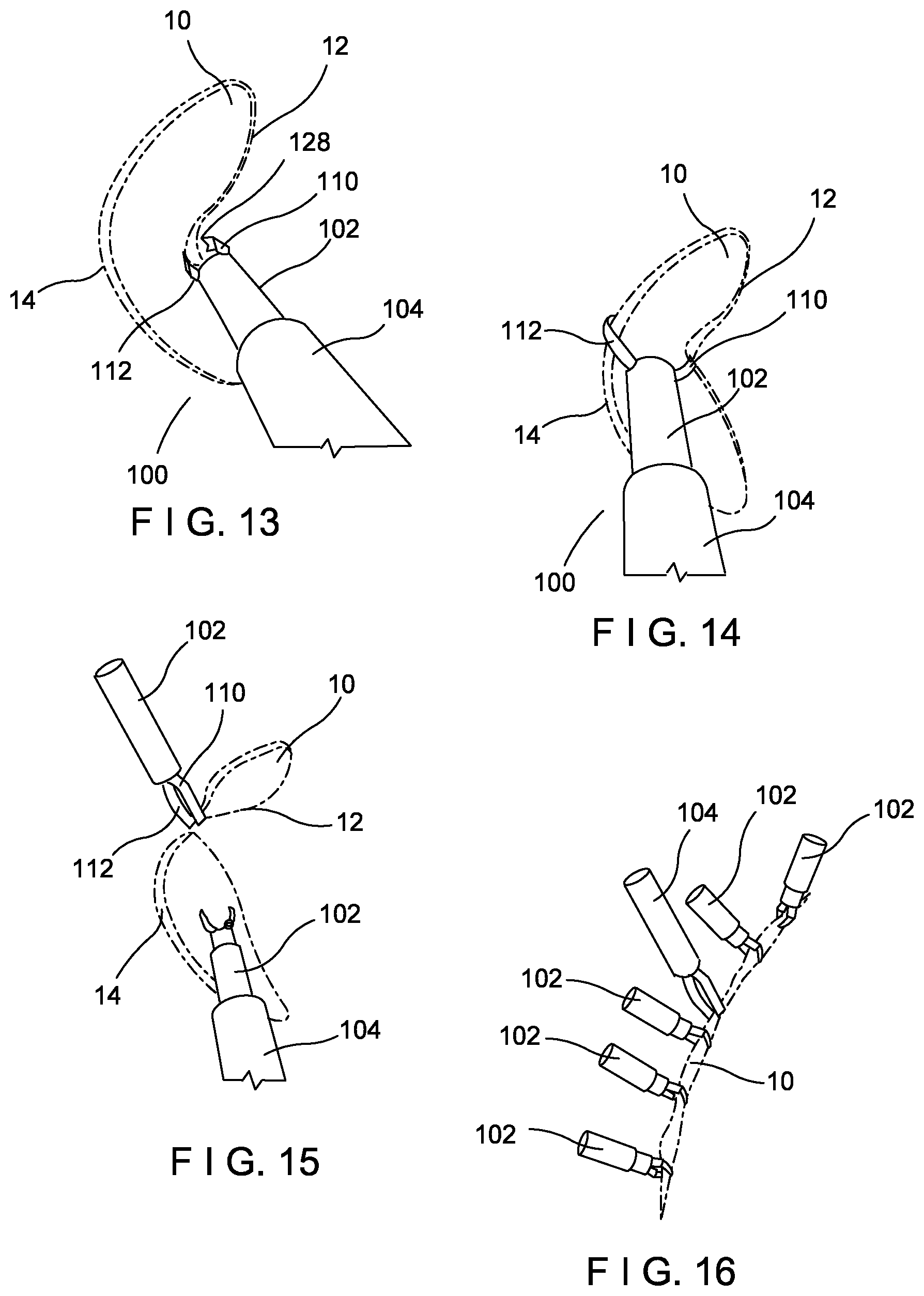 Patent US11793525 Figure 5 – Aggressive featured clips with improved tissue retention