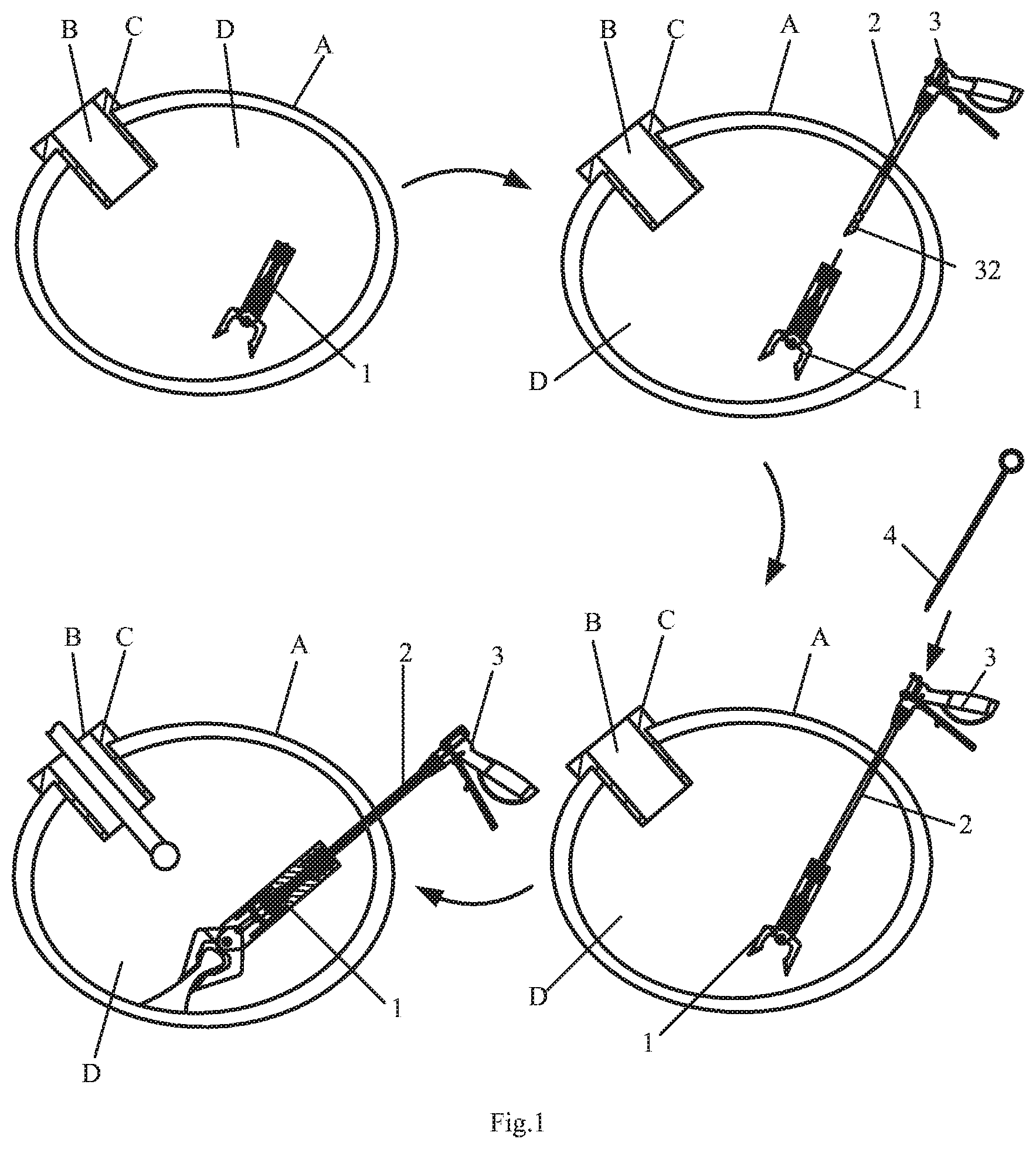 Patent US11793535 — Endoluminal surgery device — Figure 1