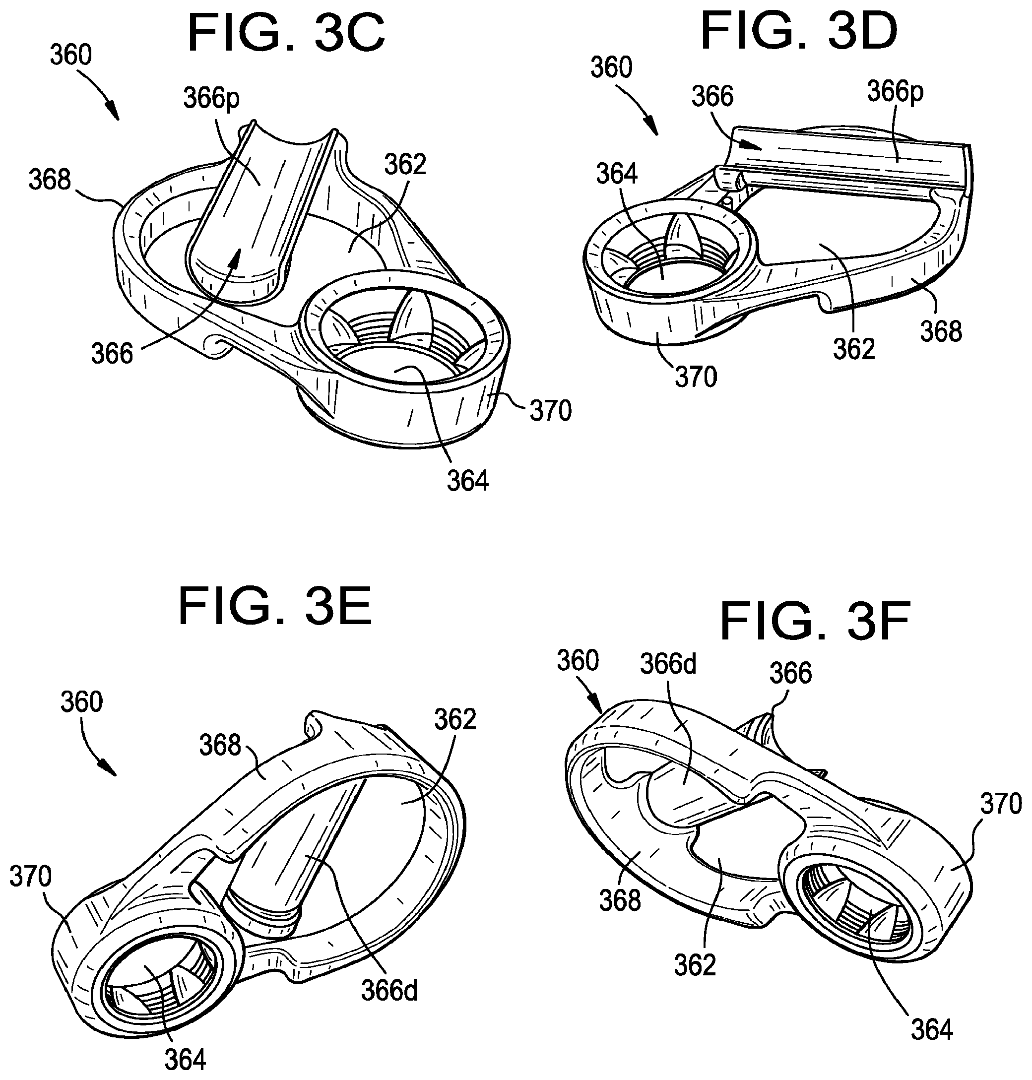 Patent US11793551 Figure 8 – Multipoint fixation implants