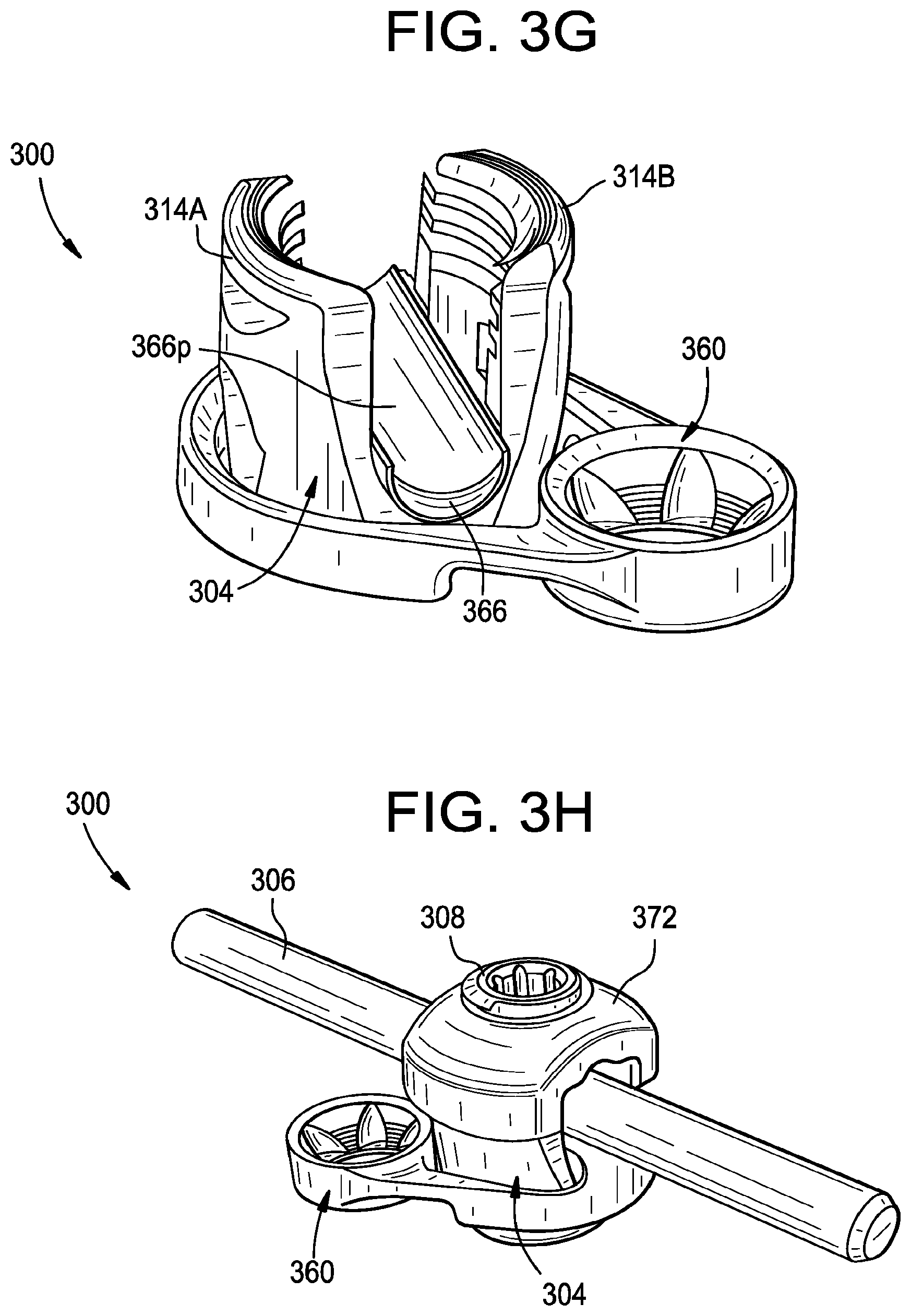 Patent US11793551 Figure 9 – Multipoint fixation implants