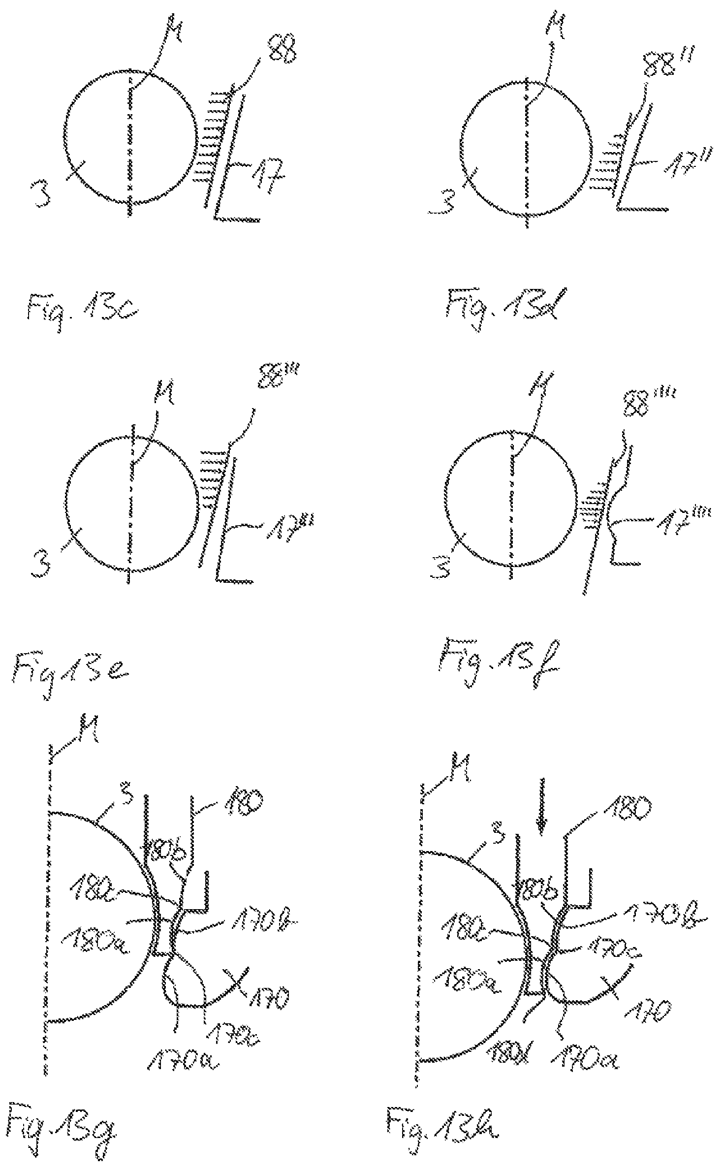 Patent US11793552 Figure 5 – Receiving part for receiving a rod for coupling the rod to a bone anchoring element and a bone anchoring device with such a receiving part