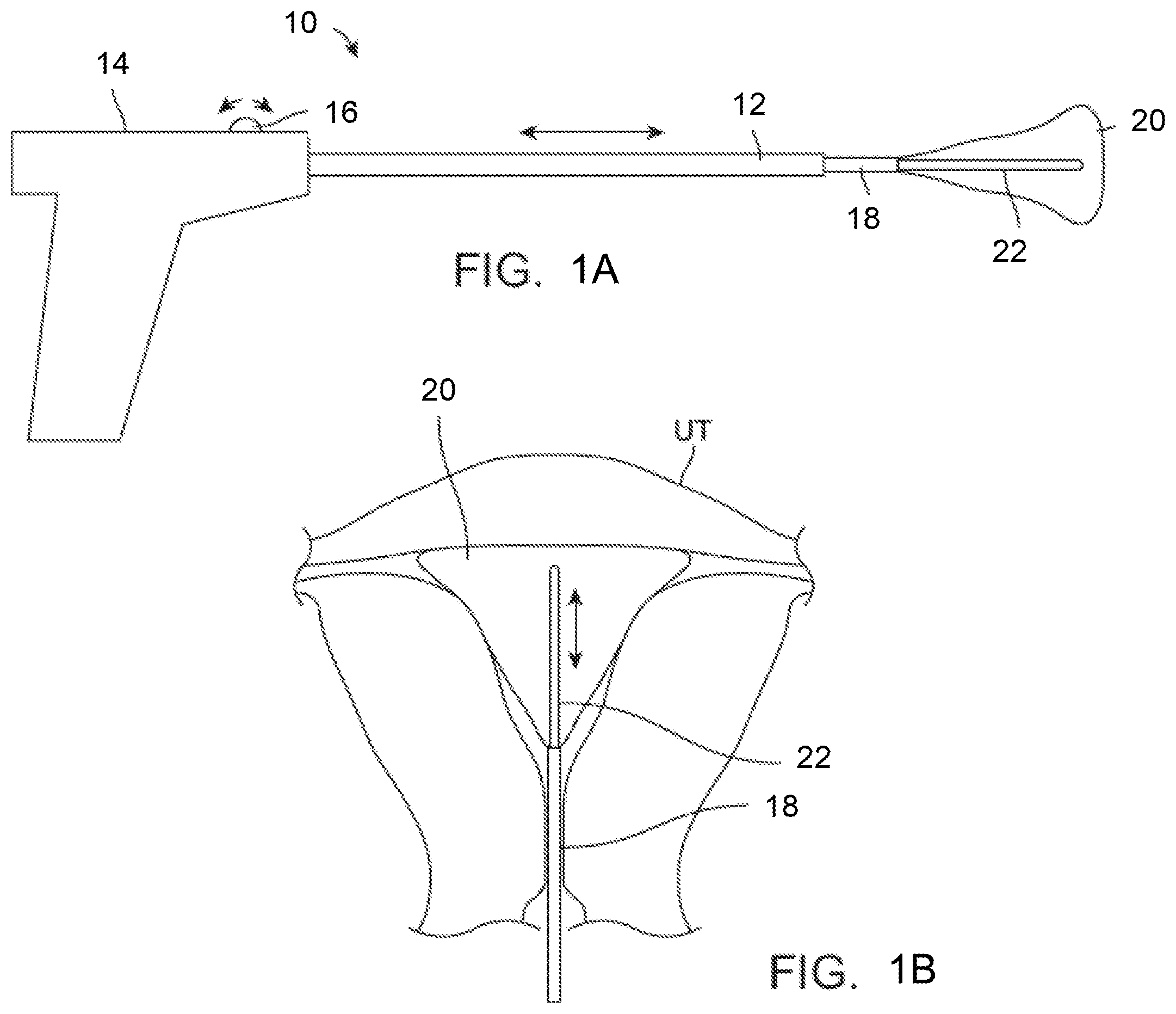 Patent US11793561 — Apparatus and methods for regulating cryogenic treatment — Figure 1