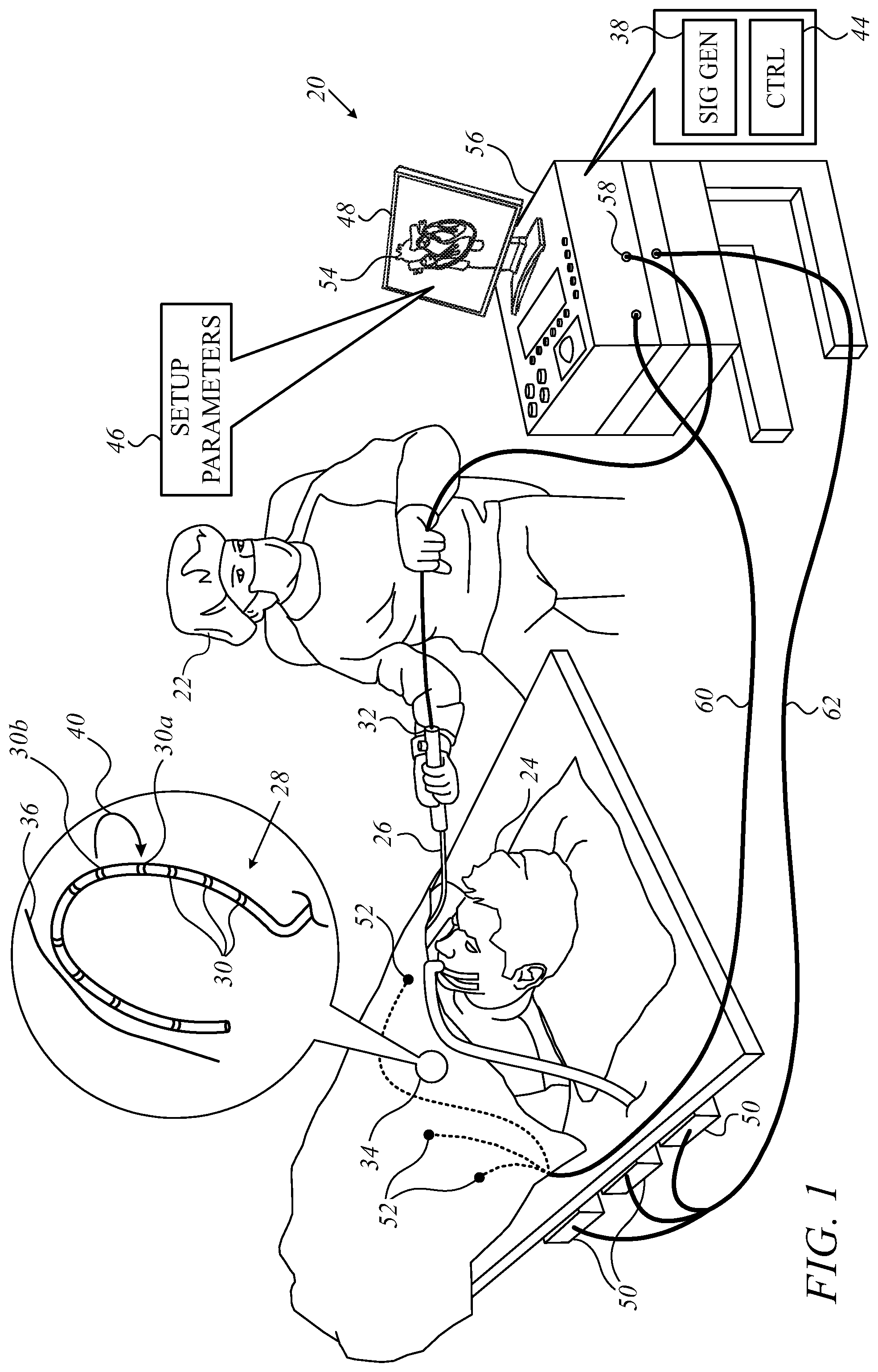 Patent US11793565 — Detecting electrode contact using absolute and relative thresholds — Figure 1