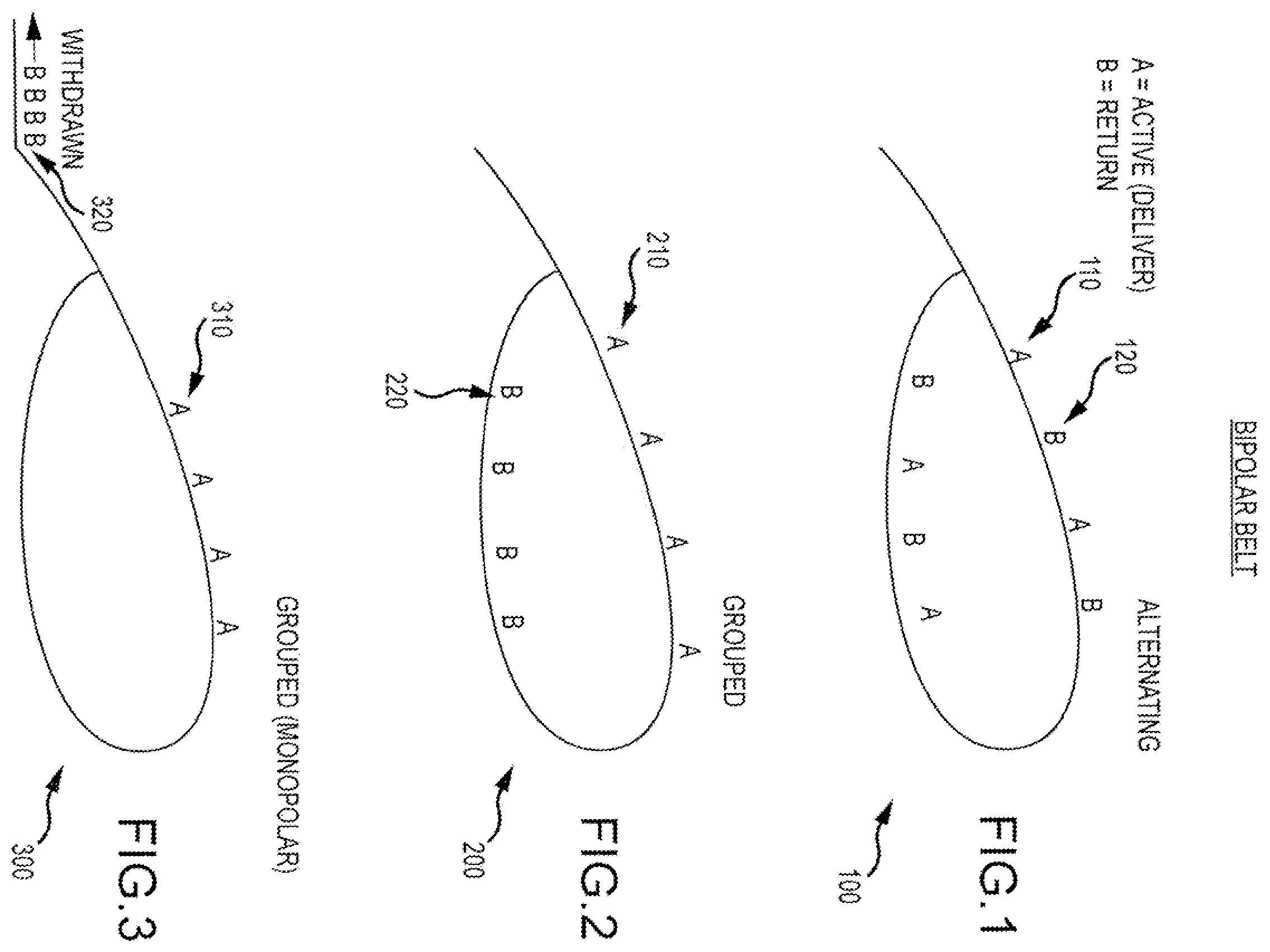 Patent US11793568 Figure 1 – Bipolar belt systems and methods