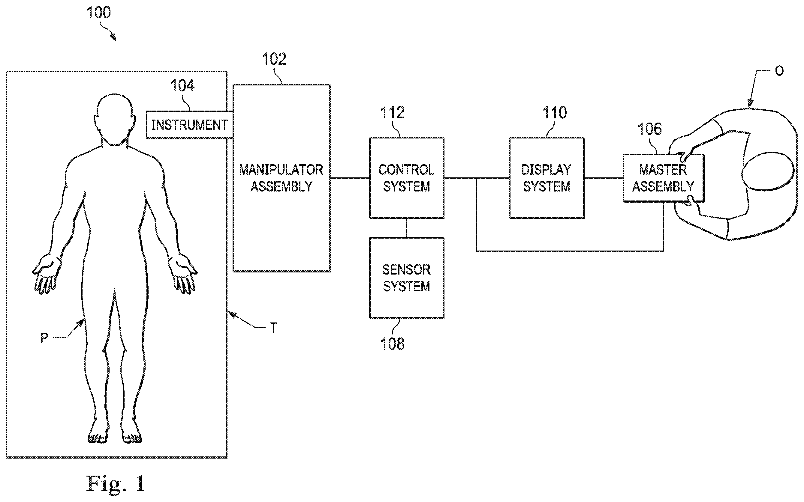 Patent US11793585 Figure 1 – Systems and methods for using a robotic medical system