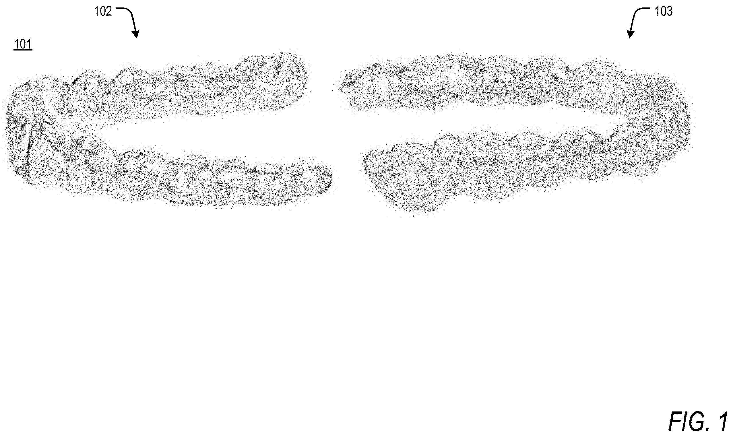 Patent US11793605 — Apparatus and methods for orthodontic treatment planning — Figure 1