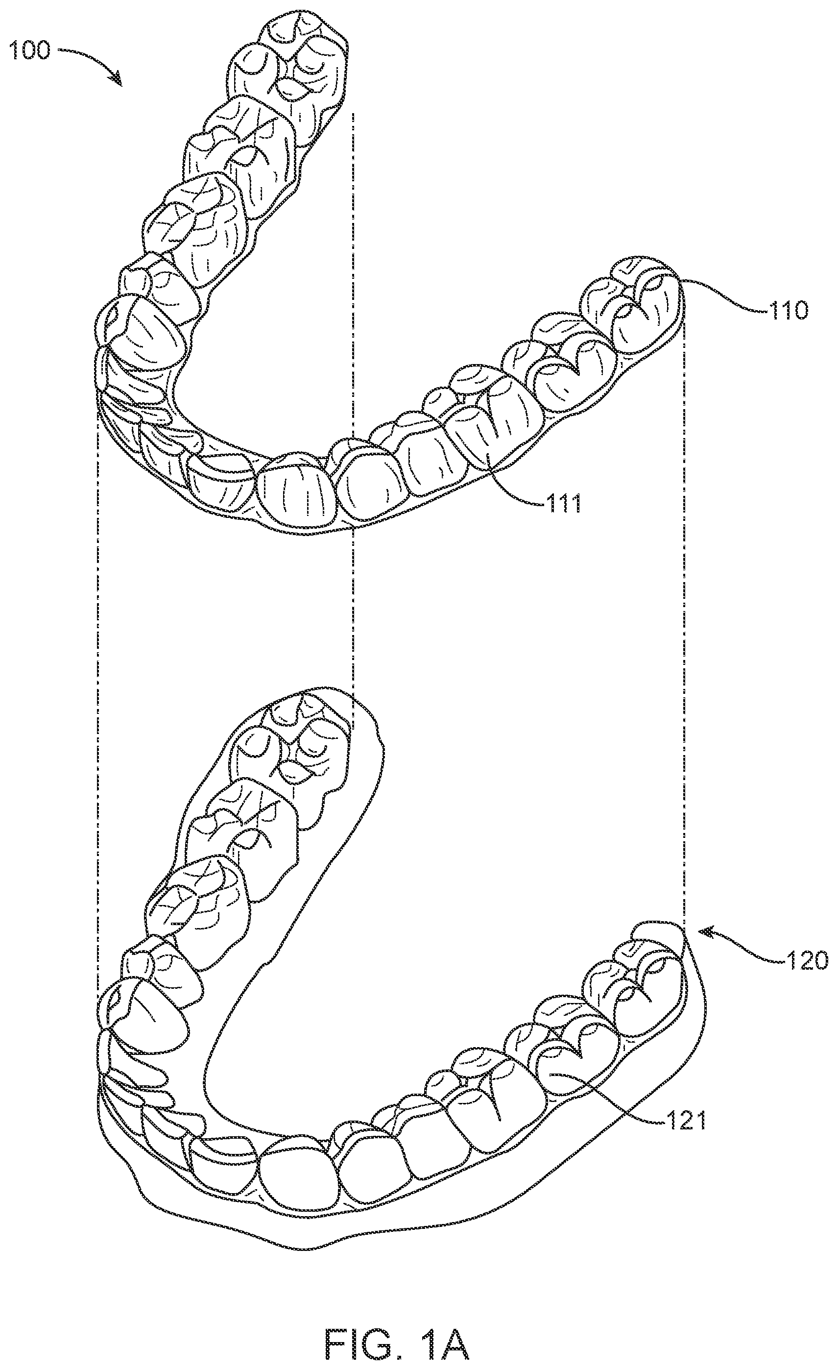 Patent US11793606 Figure 1 – Devices, systems, and methods for dental arch expansion
