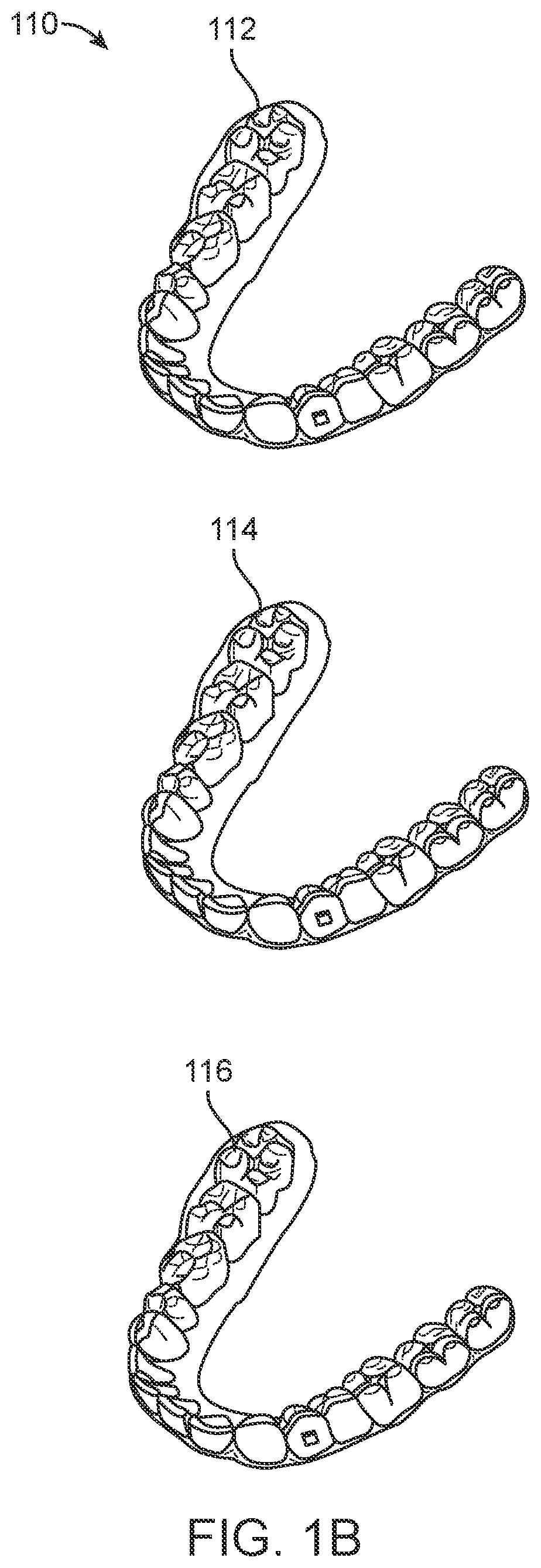 Patent US11793606 Figure 2 – Devices, systems, and methods for dental arch expansion