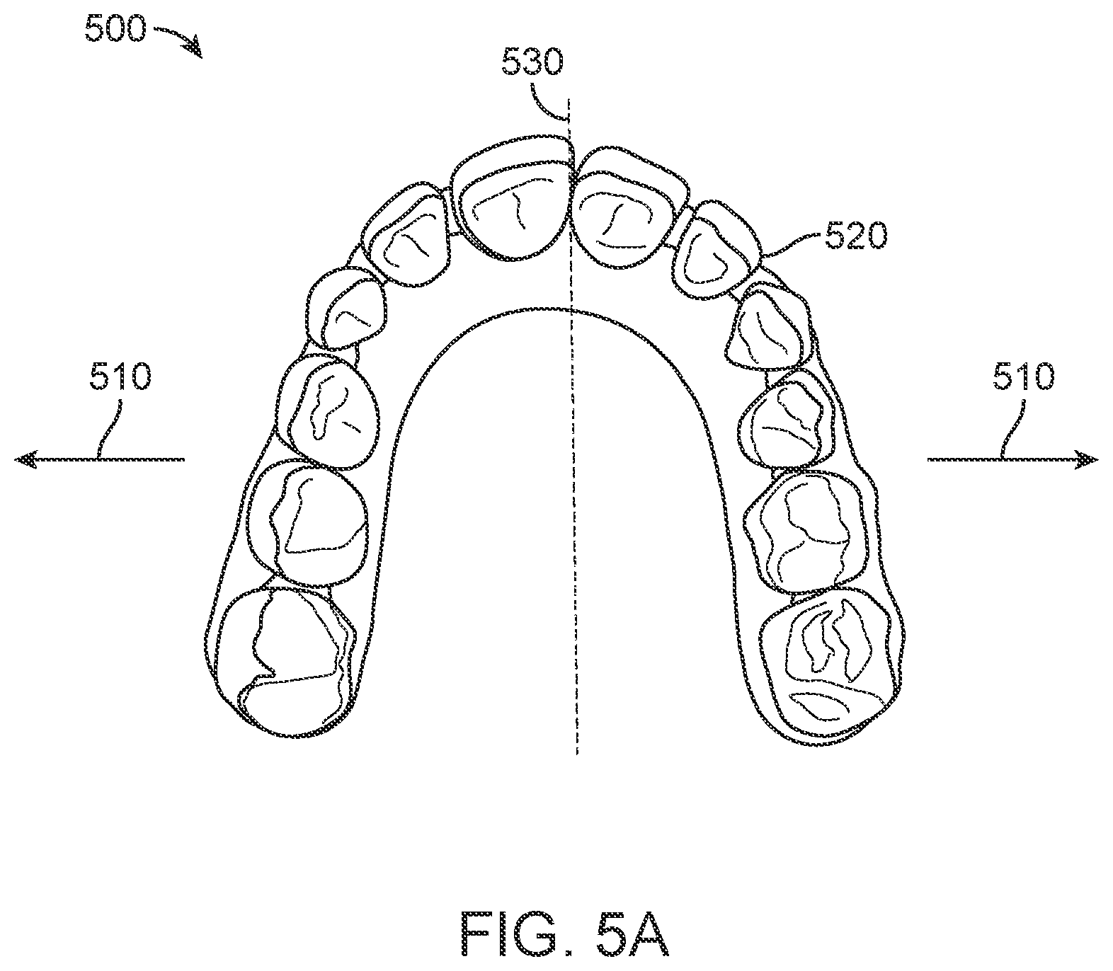 Patent US11793606 Figure 7 – Devices, systems, and methods for dental arch expansion