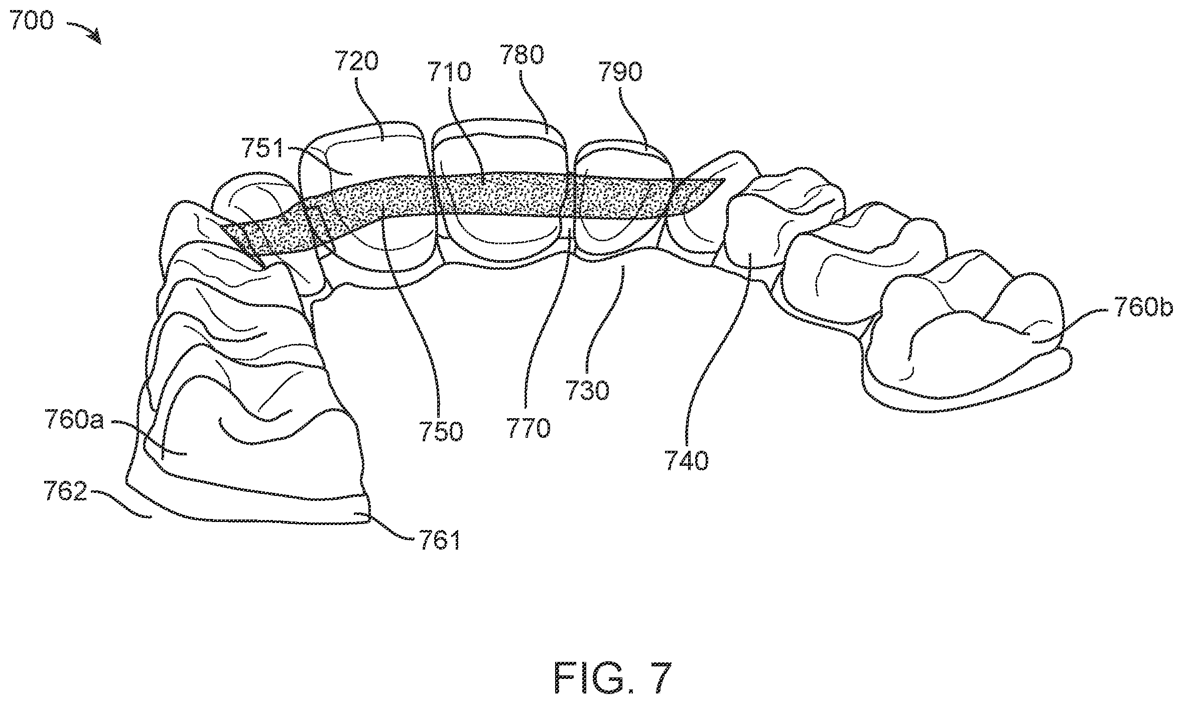 Patent US11793606 Figure 10 – Devices, systems, and methods for dental arch expansion