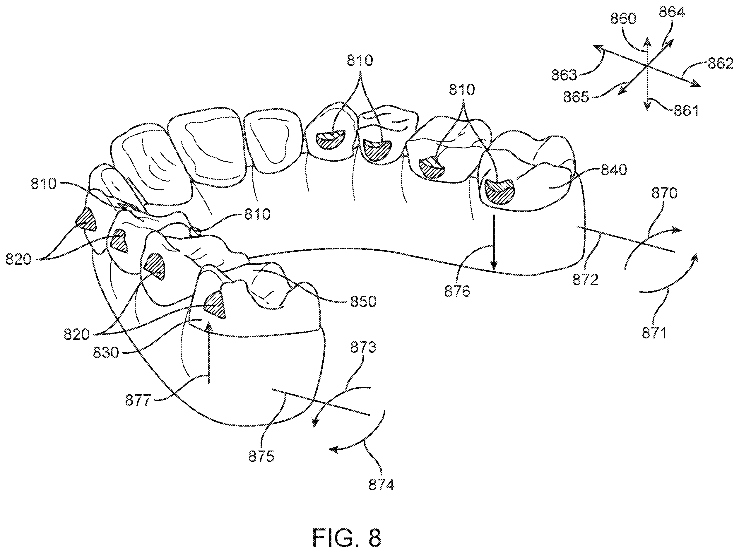 Patent US11793606 Figure 11 – Devices, systems, and methods for dental arch expansion