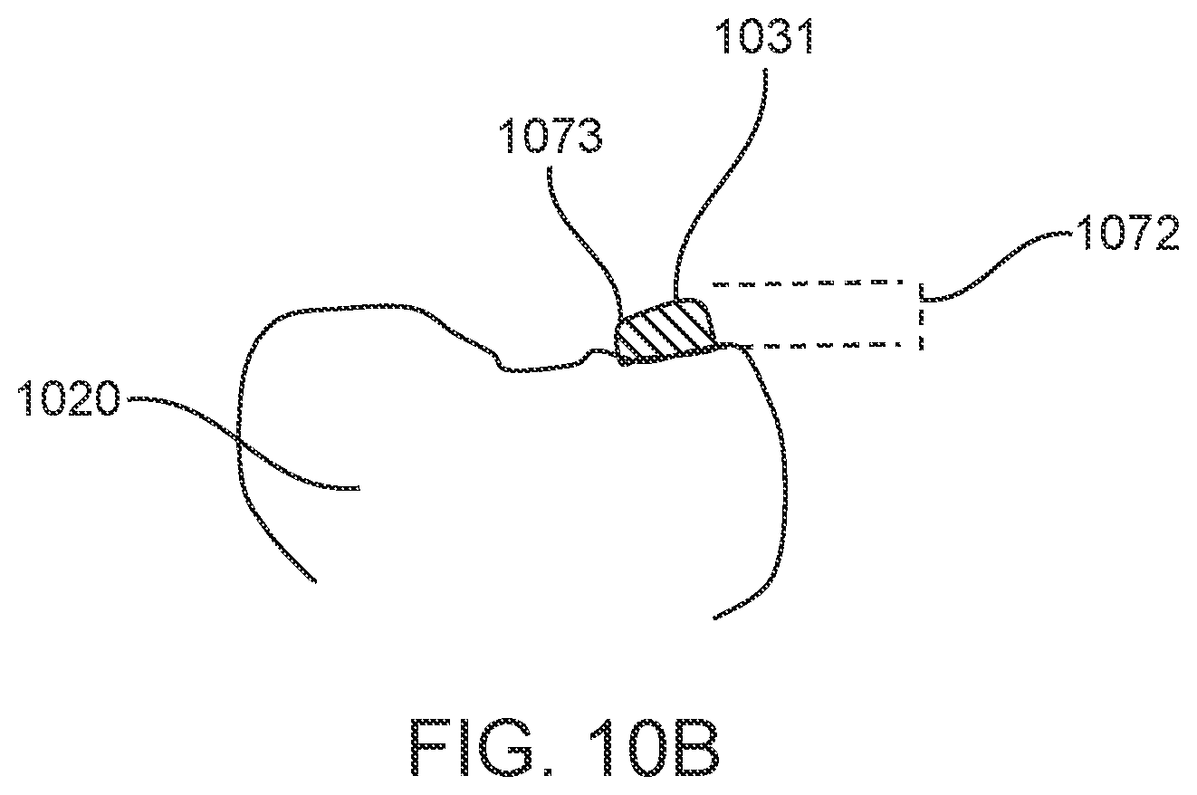 Patent US11793606 Figure 15 – Devices, systems, and methods for dental arch expansion