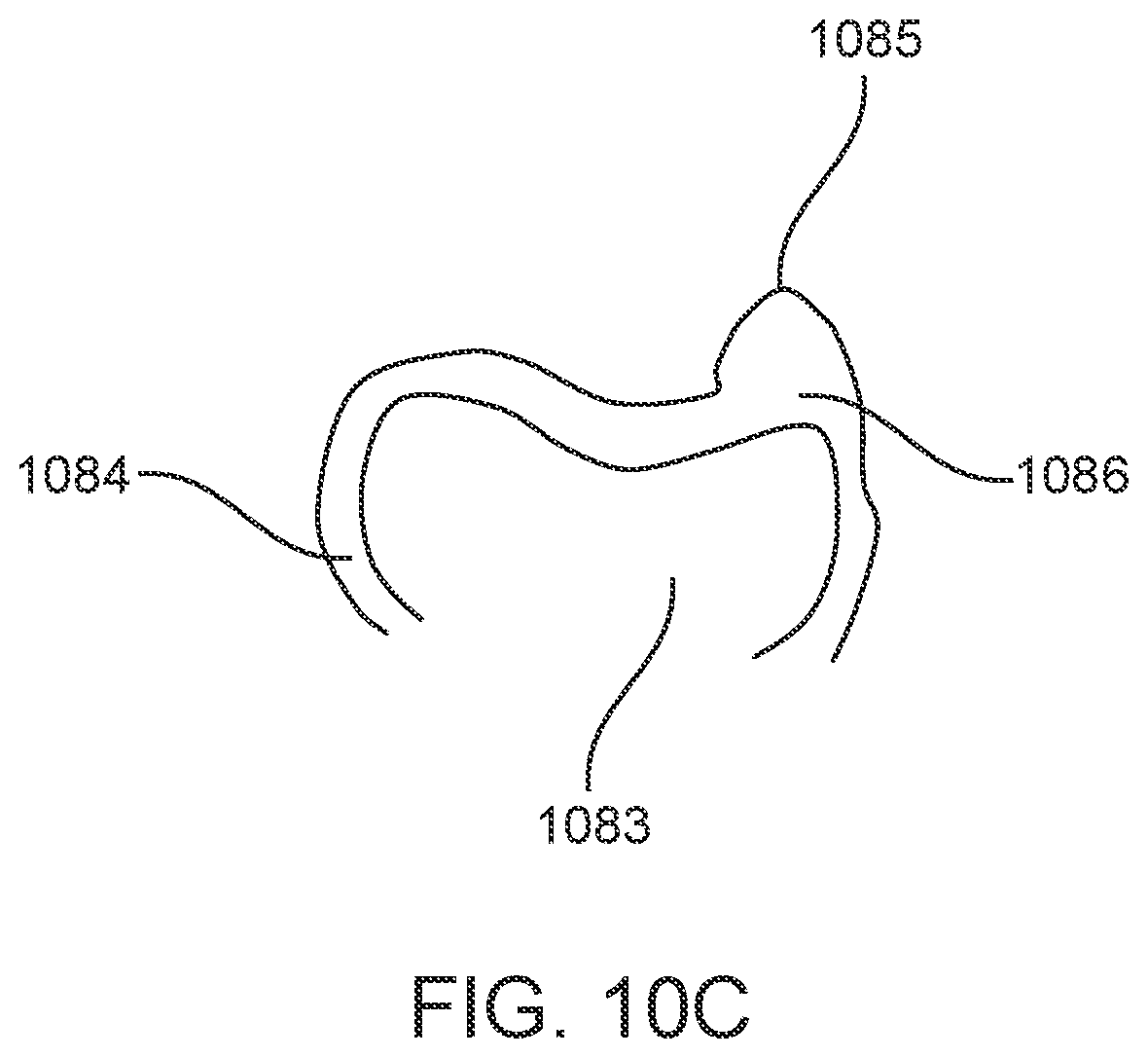 Patent US11793606 Figure 16 – Devices, systems, and methods for dental arch expansion