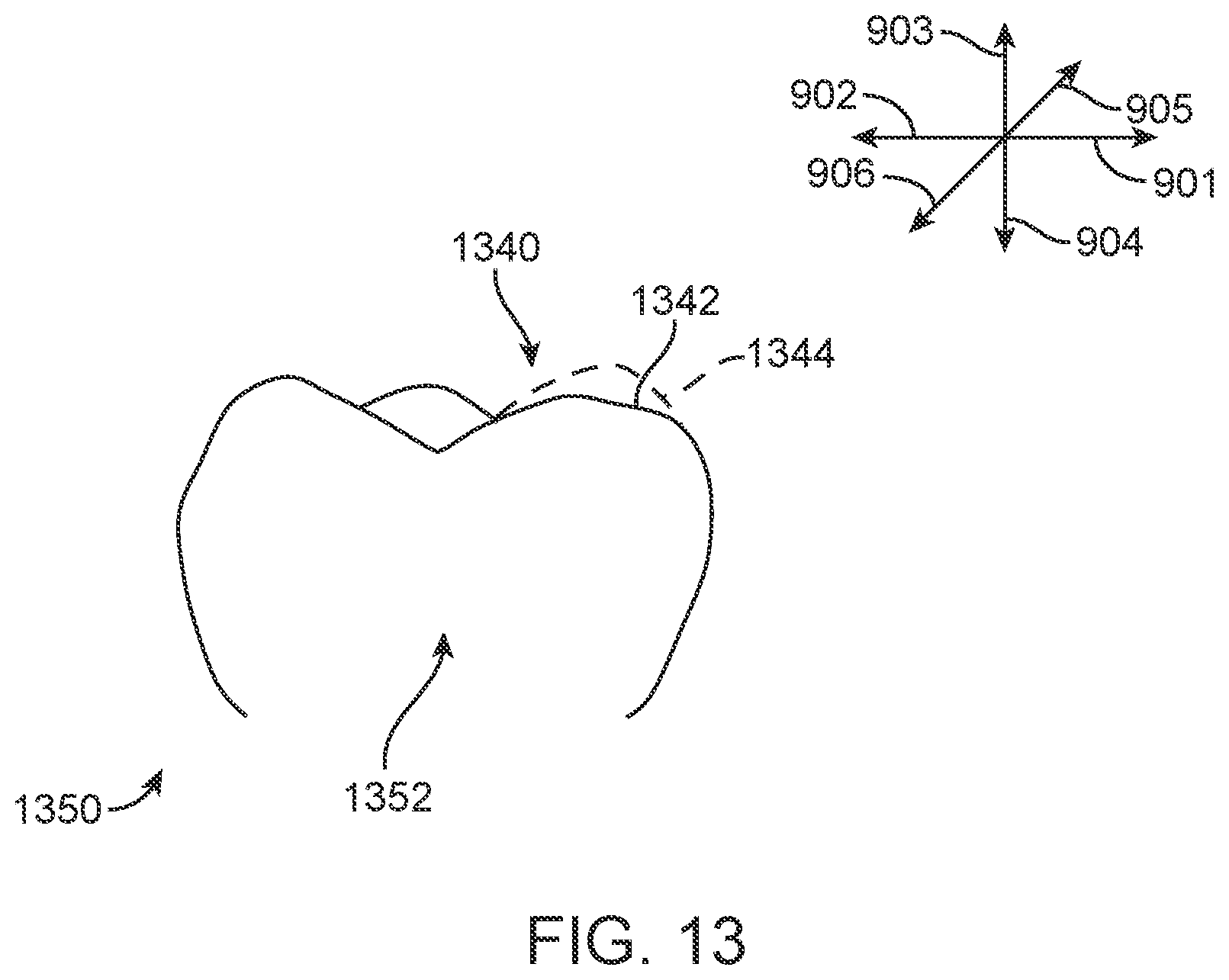 Patent US11793606 Figure 20 – Devices, systems, and methods for dental arch expansion