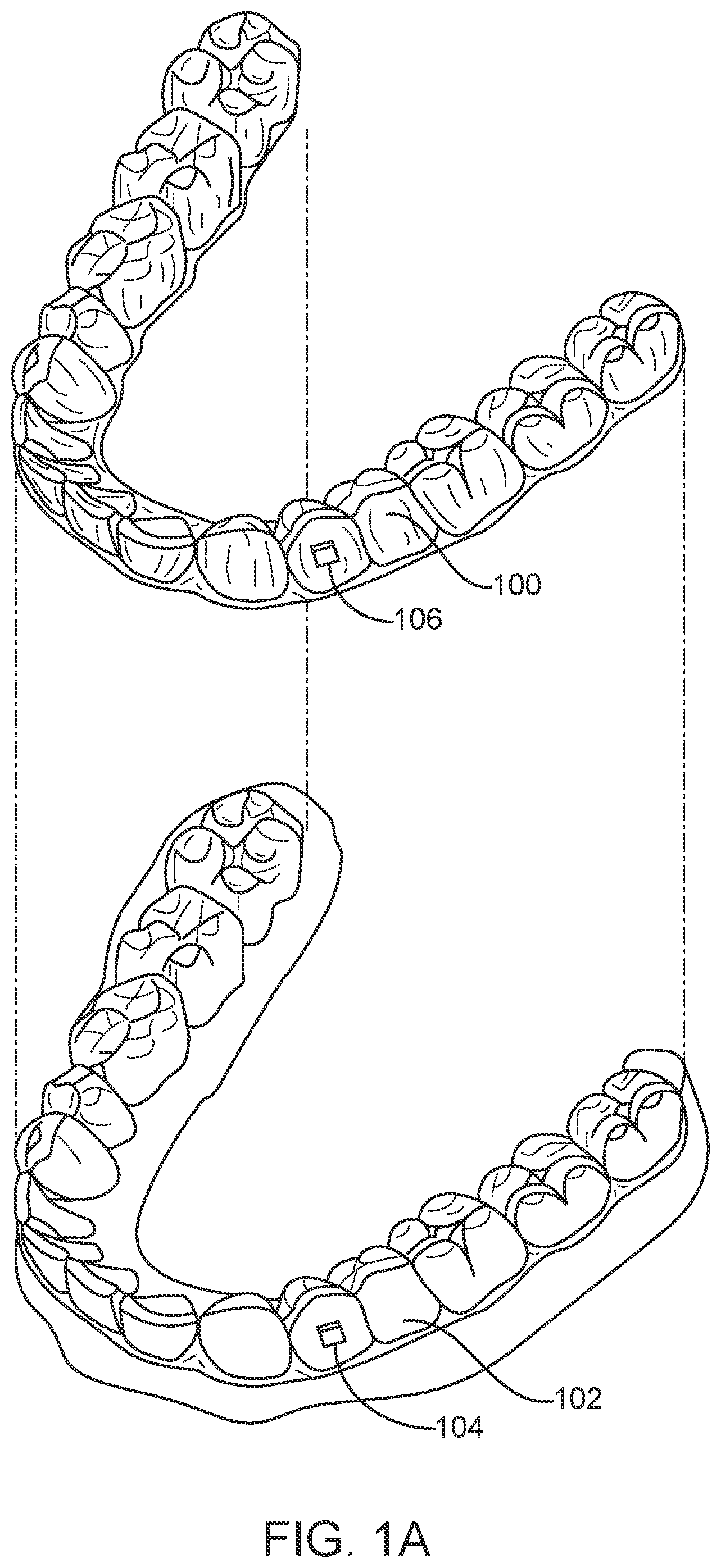 Patent US11793608 — Systems and methods for correcting malocclusions of teeth — Figure 1