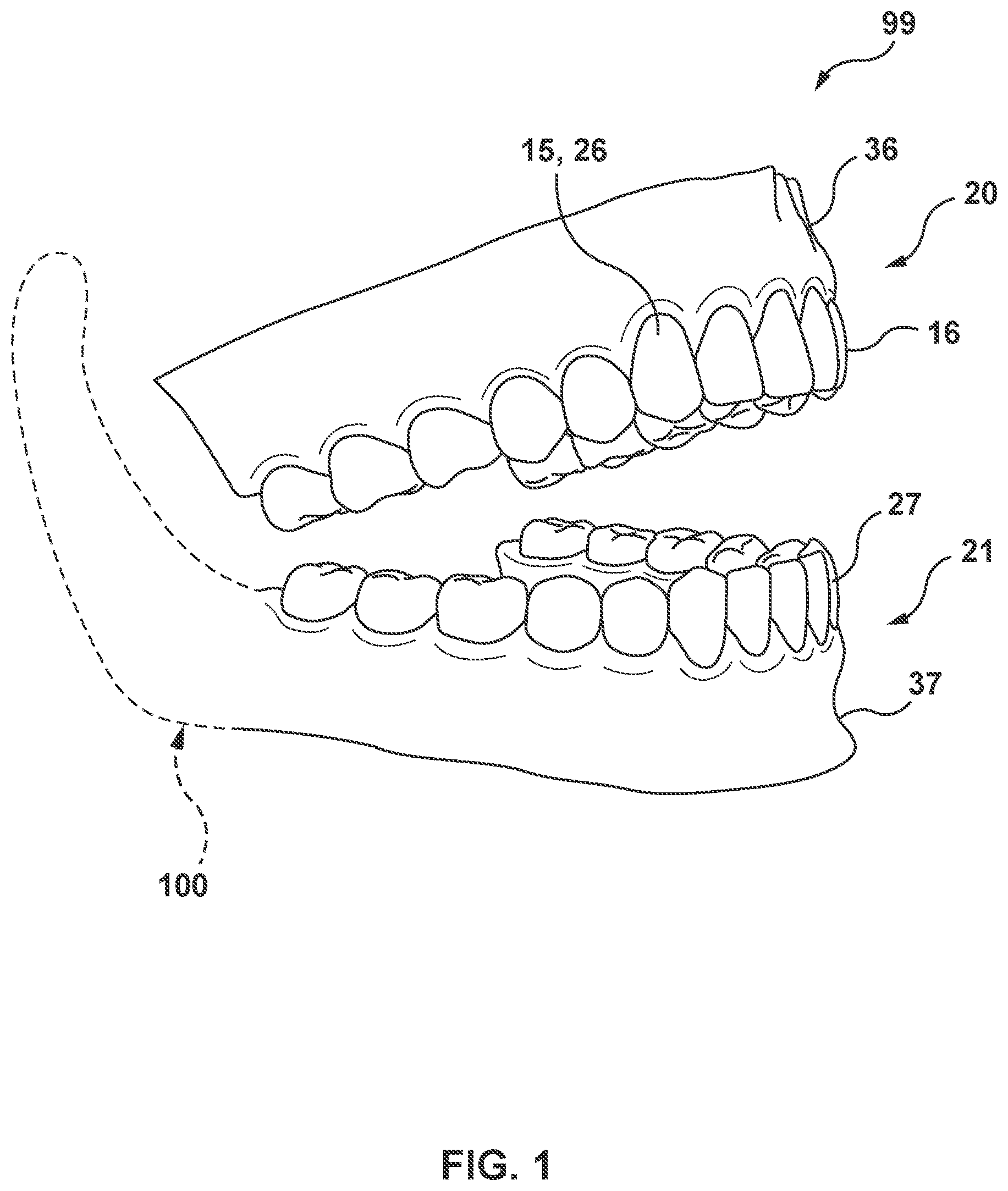 Patent US11793612 — Methods and systems for modeling mandibular motion — Figure 1