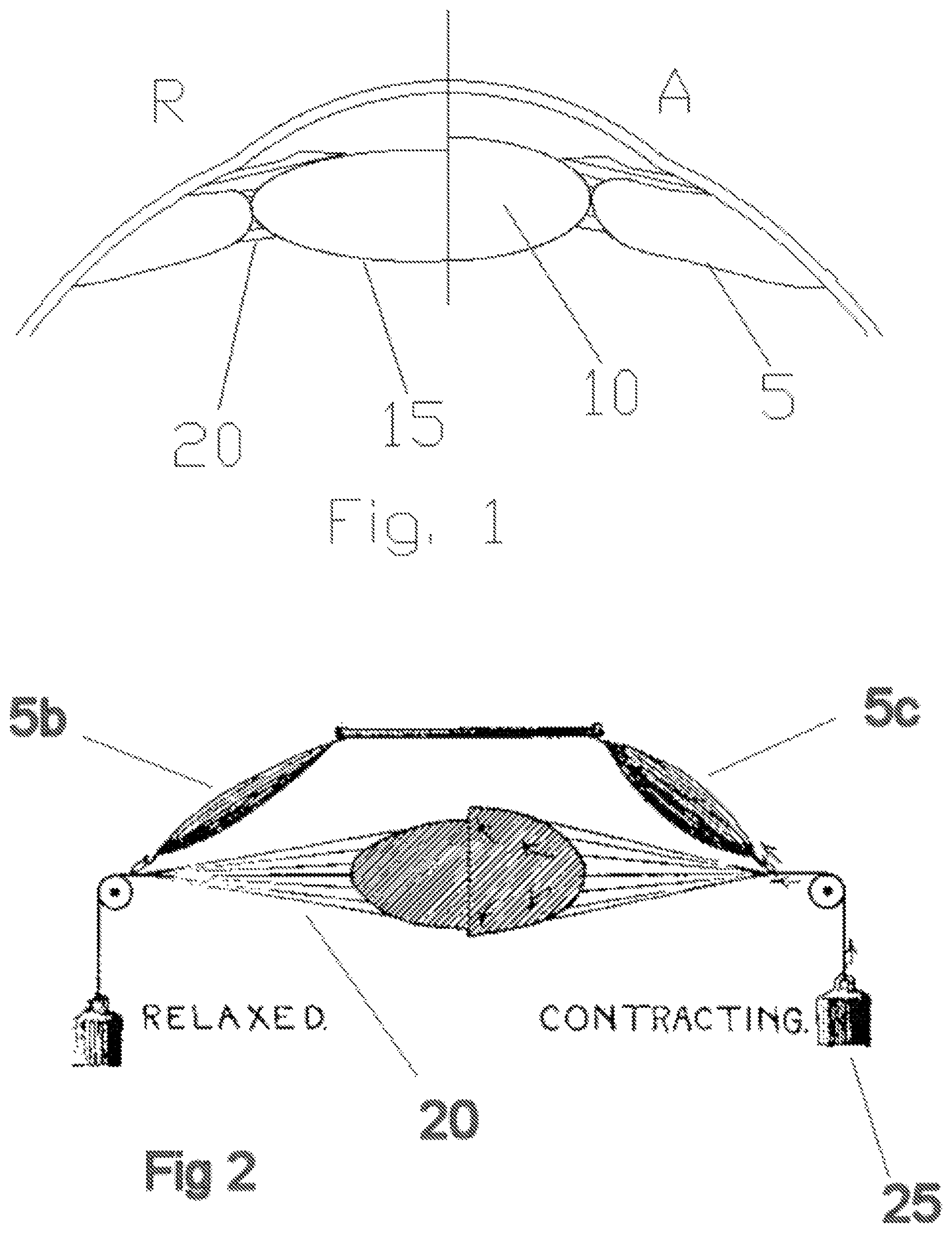 Patent US11793625 — Systems, devices, and/or methods for managing implantable devices — Figure 1