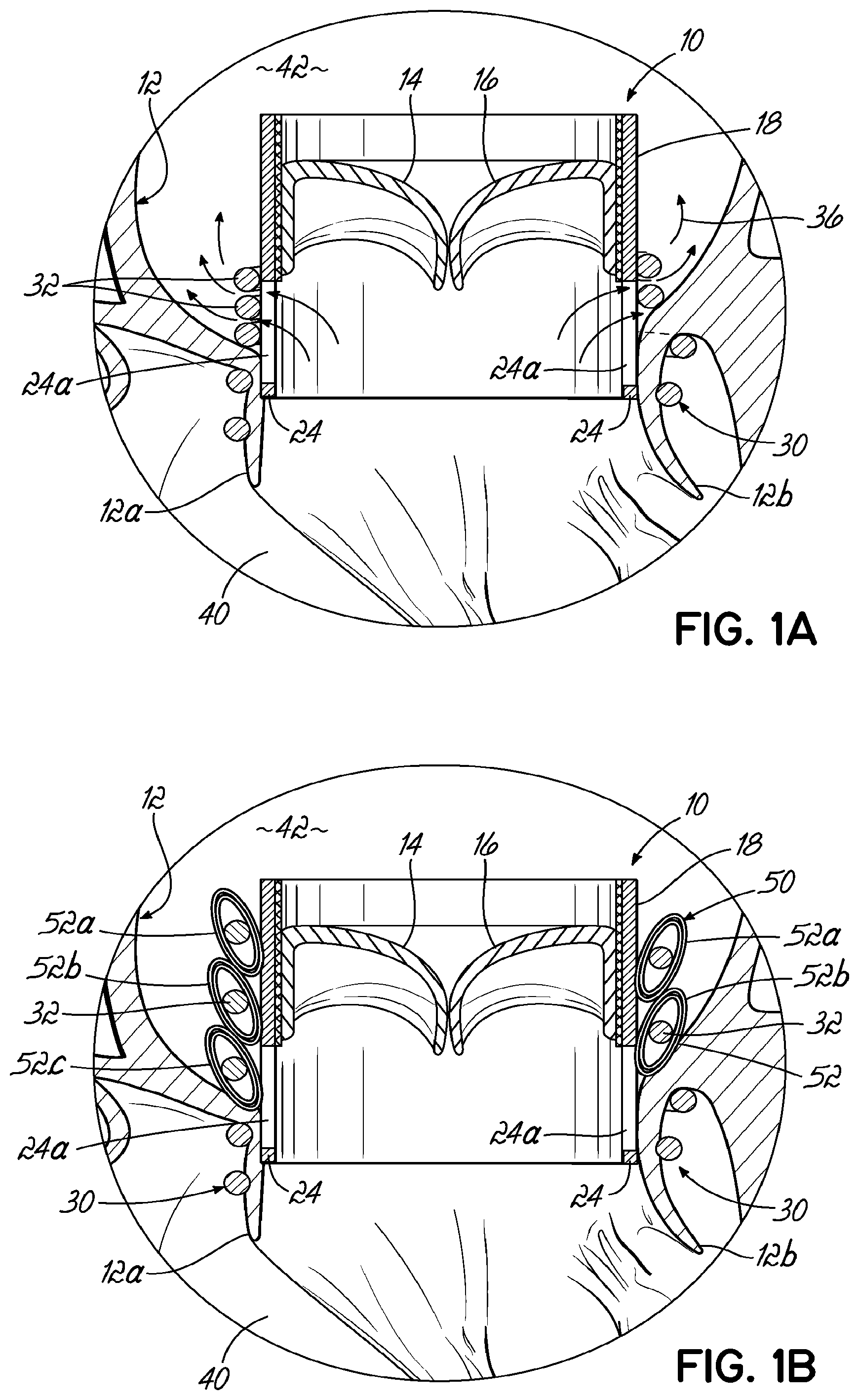 Patent US11793630 — Apparatus and methods for implanting a replacement heart valve — Figure 1