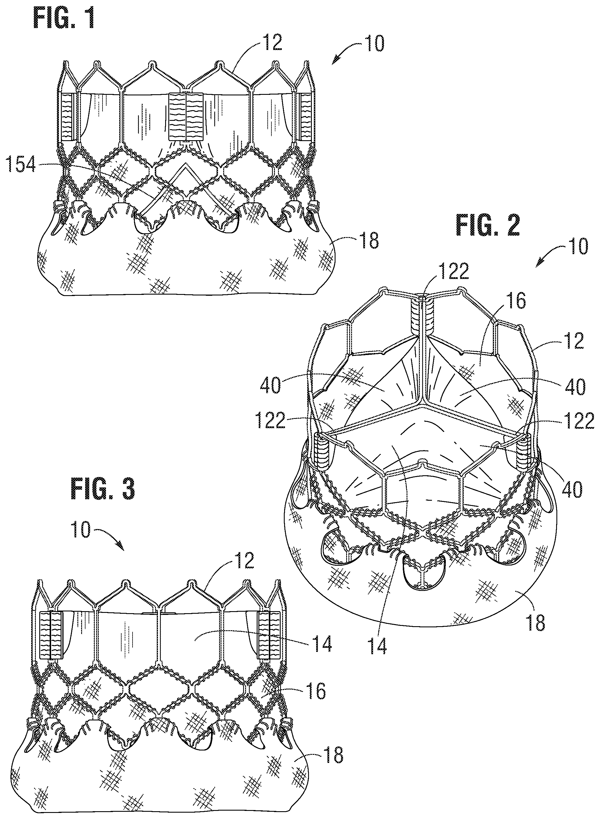 Patent US11793632 — Prosthetic heart valve — Figure 1