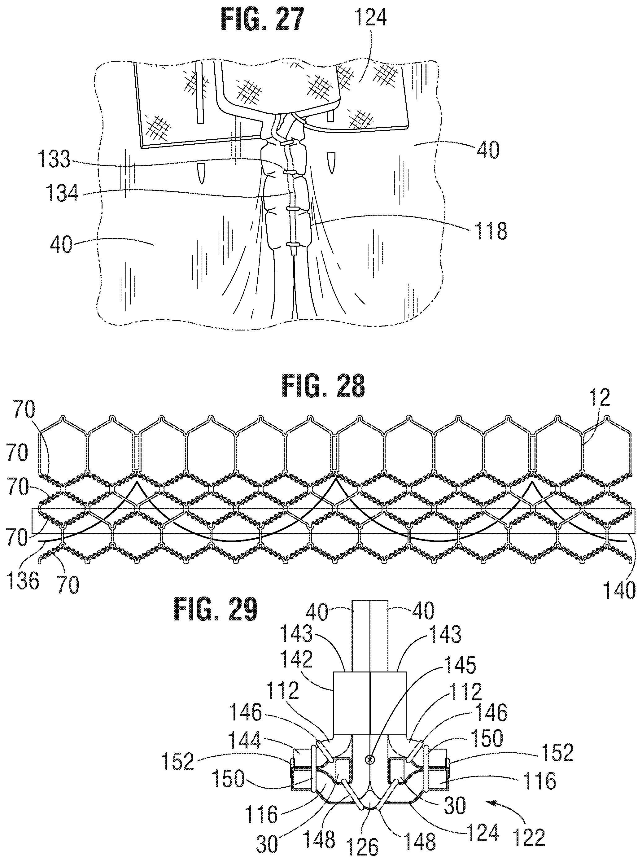 Patent US11793632 Figure 9 – Prosthetic heart valve