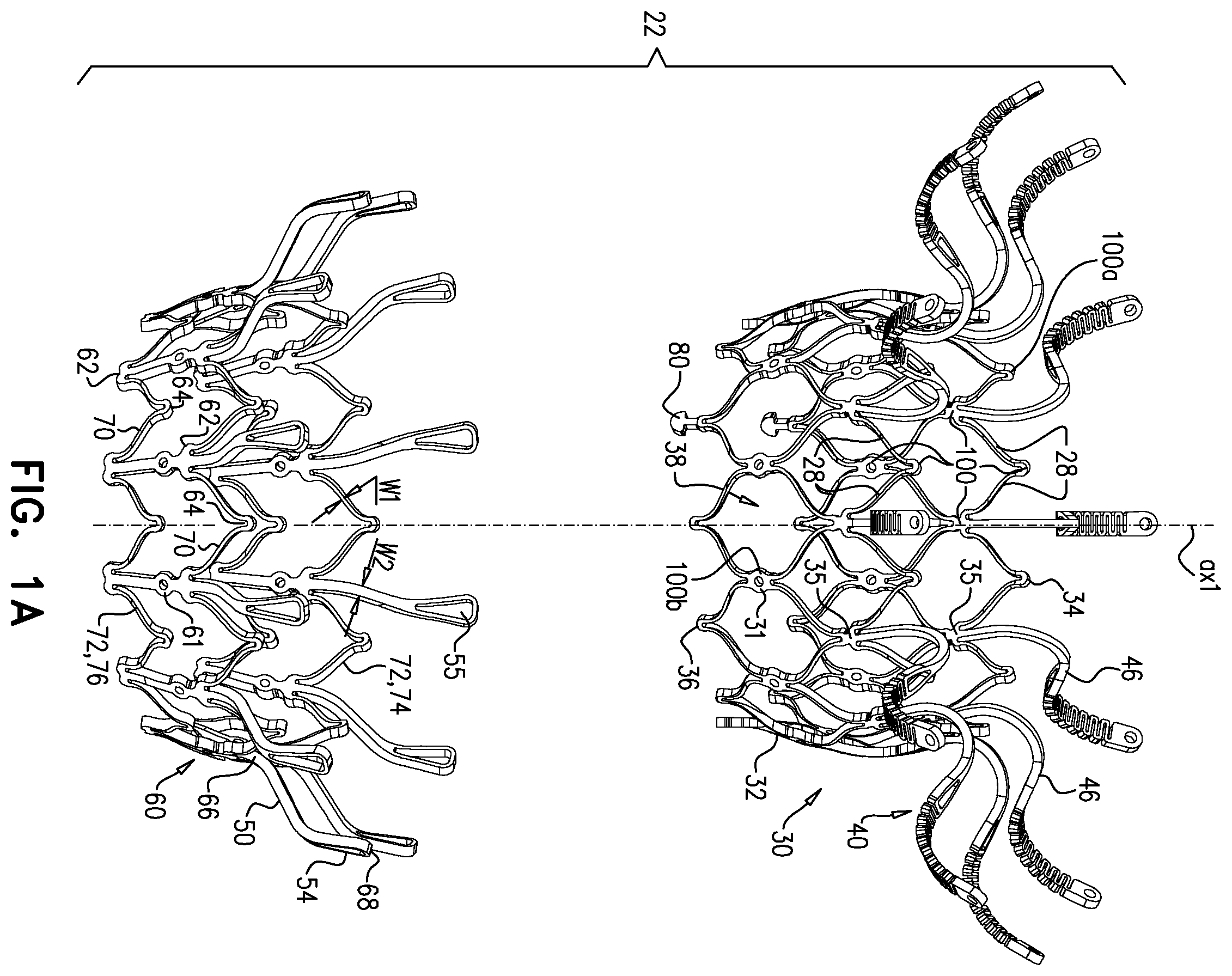 Patent US11793633 — Prosthetic heart valve — Figure 1
