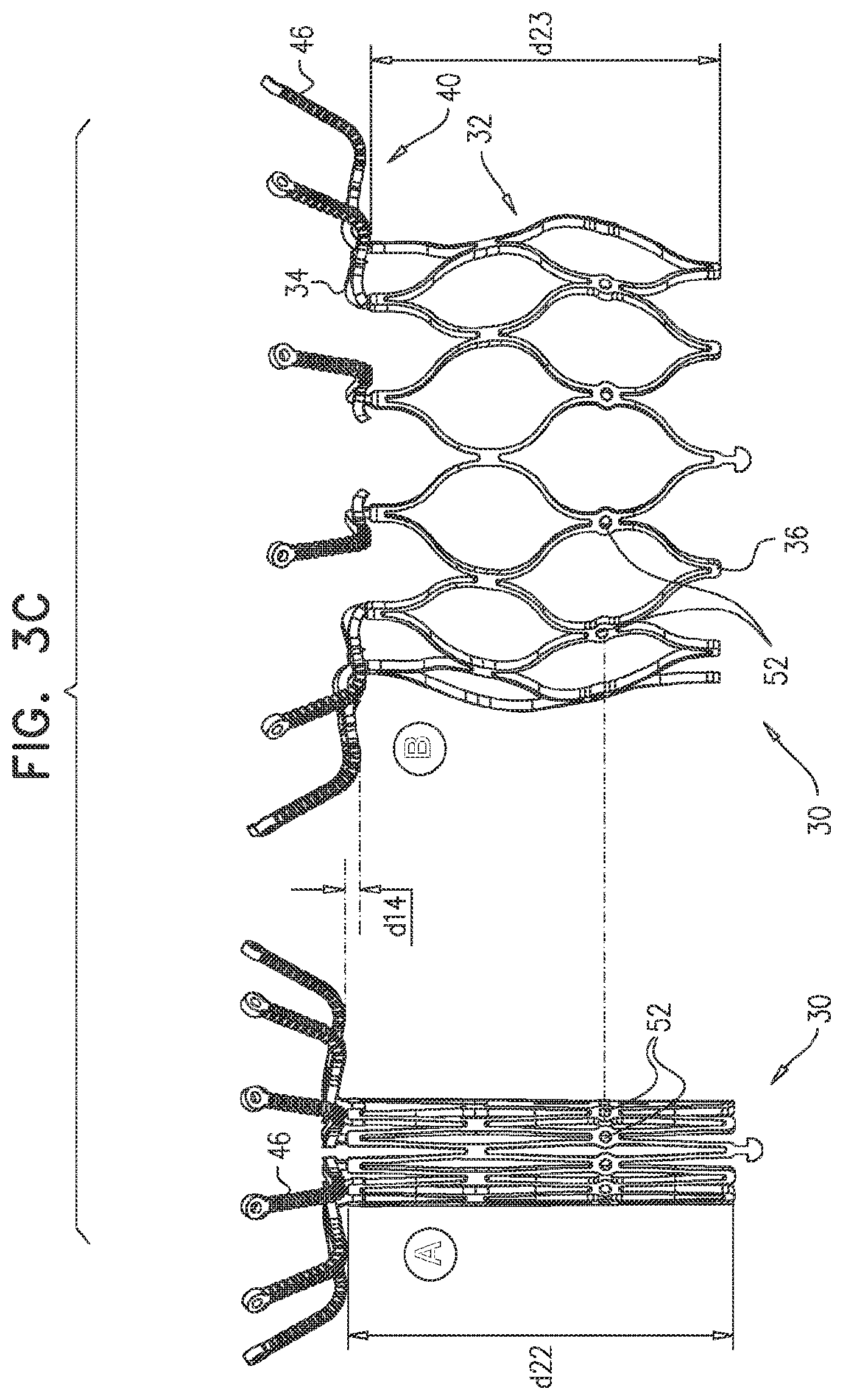 Patent US11793635 Figure 6 – Prosthetic valve with angularly offset frames