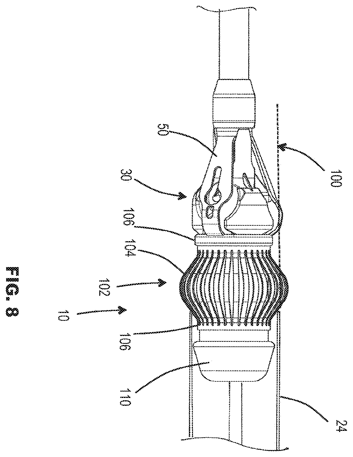 Patent US11793636 Figure 7 – Prosthetic valve. delivery apparatus and delivery method