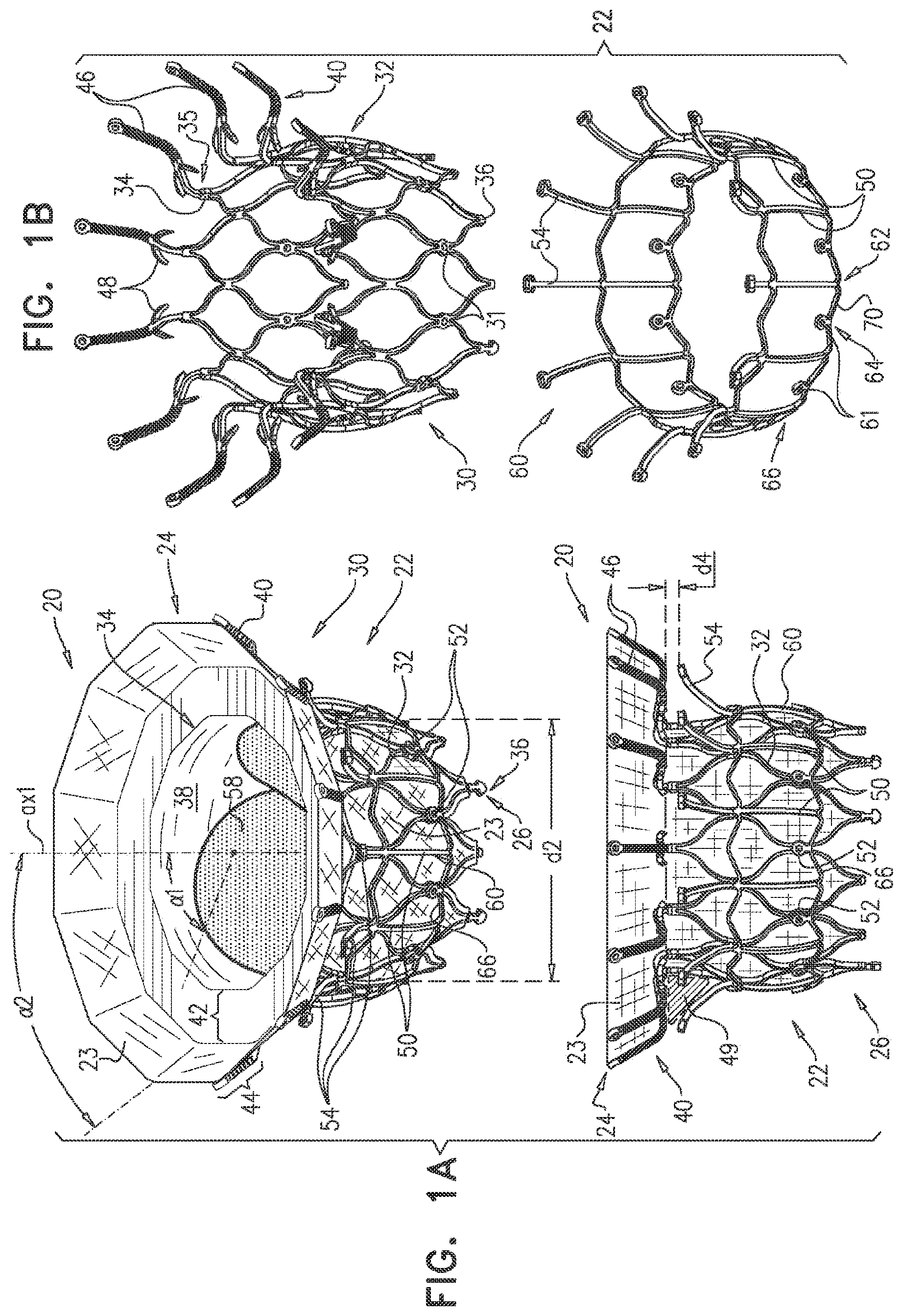 Patent US11793638 Figure 1 – Prosthetic valve with pivoting tissue anchor portions