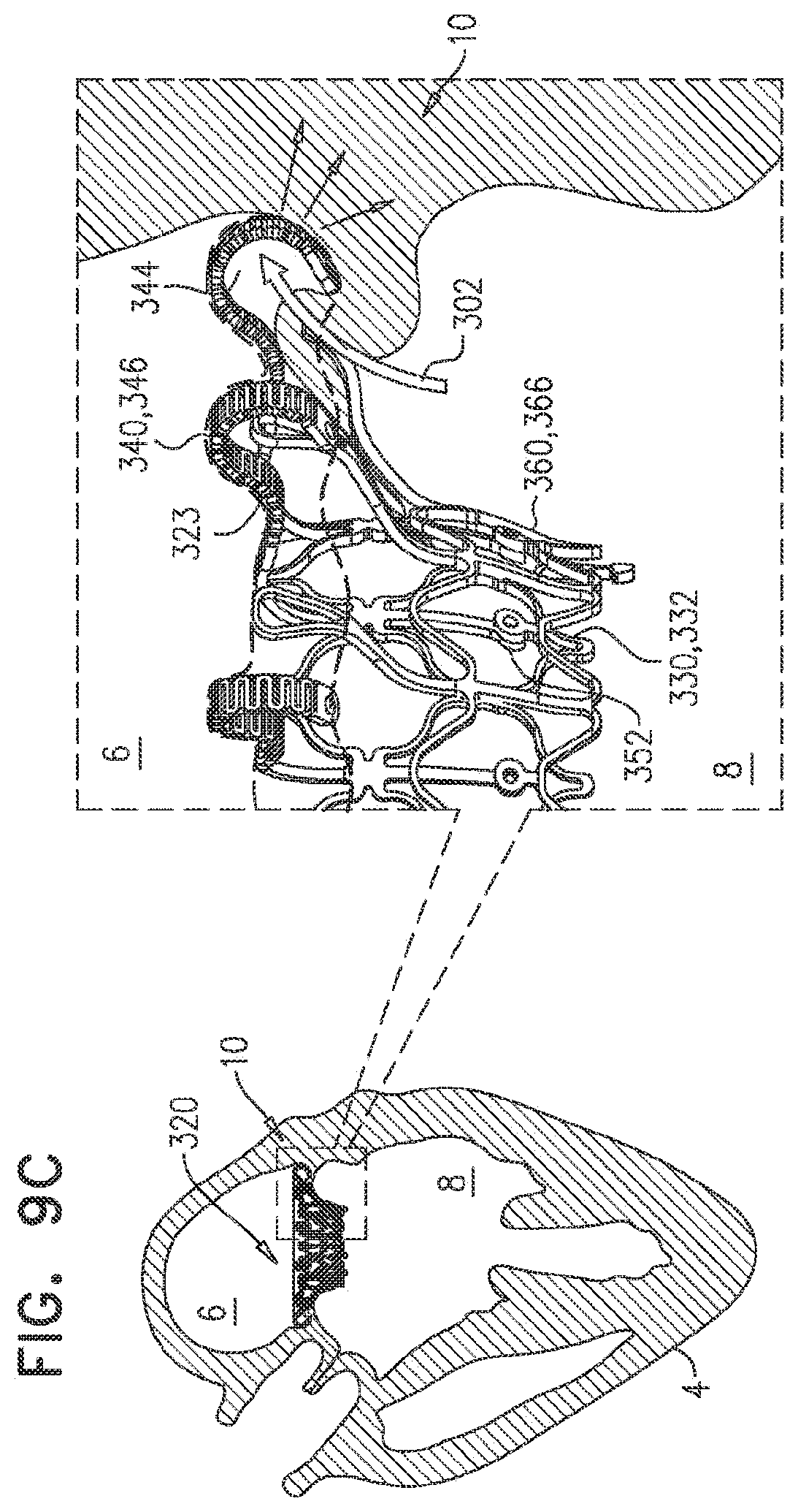 Patent US11793638 Figure 15 – Prosthetic valve with pivoting tissue anchor portions