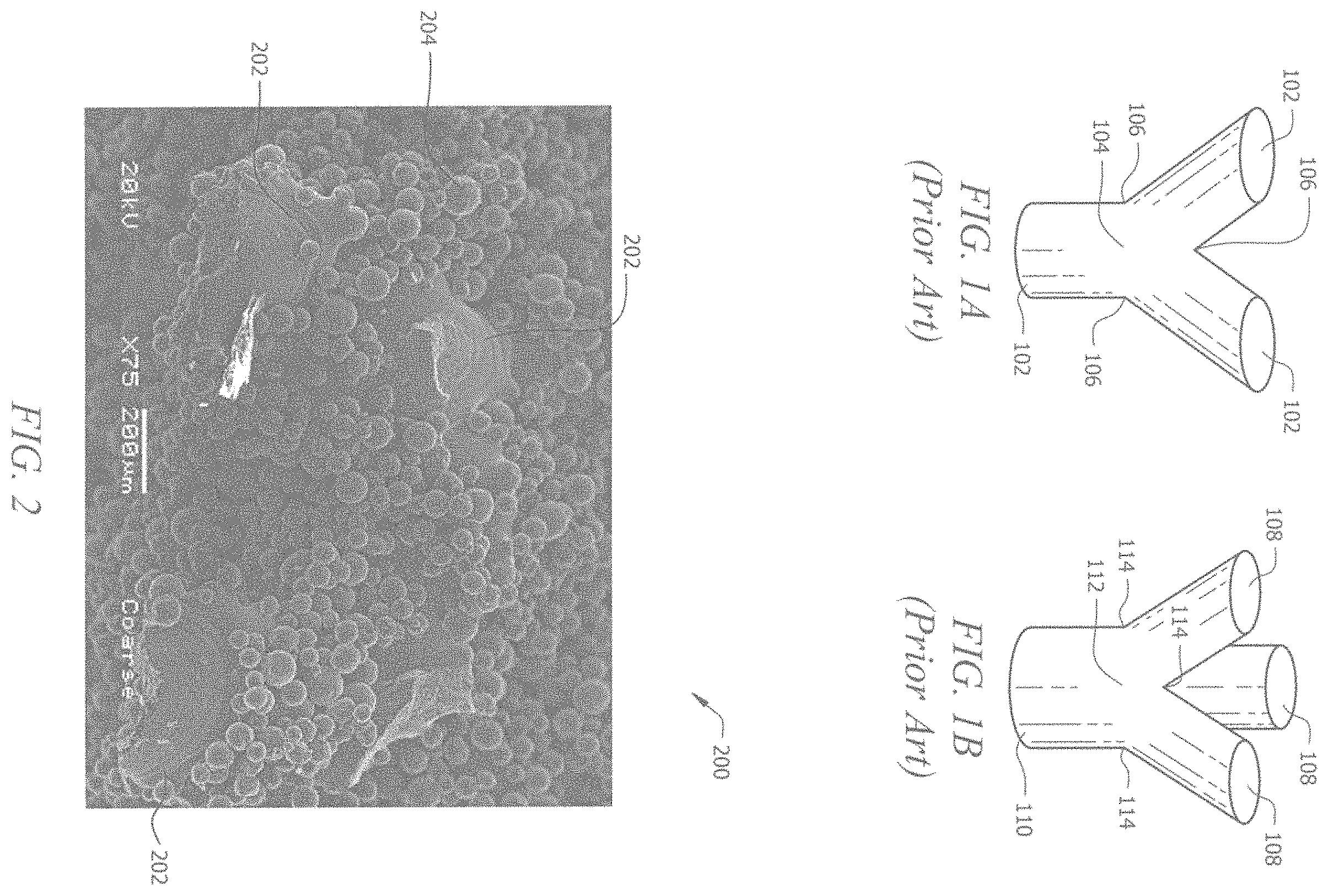 Patent US11793645 — Porous implant structures — Figure 1
