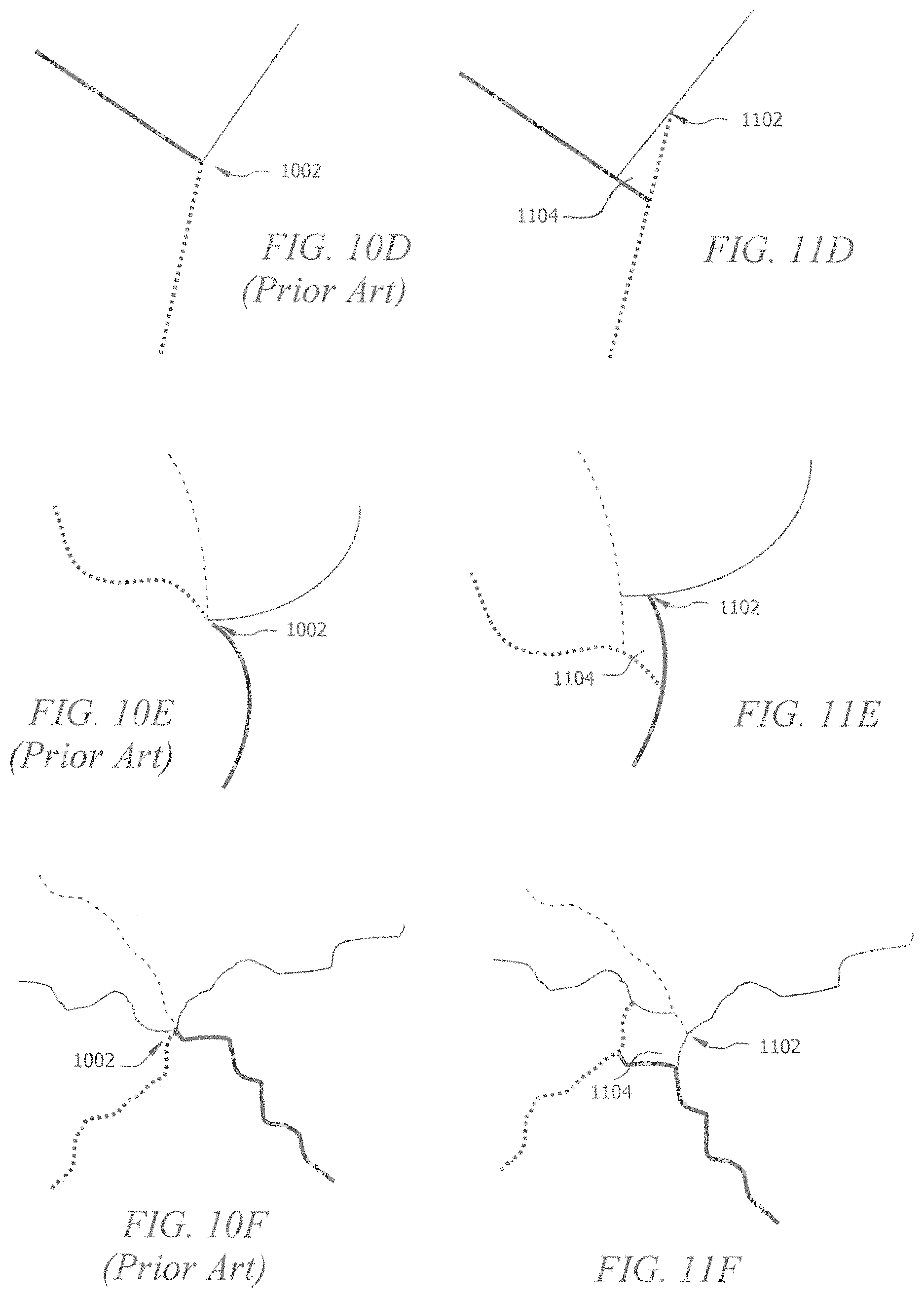 Patent US11793645 Figure 5 – Porous implant structures