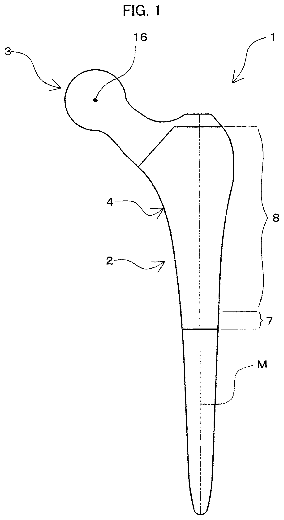 Patent US11793648 — Prosthetic joint and manufacturing method for same — Figure 1