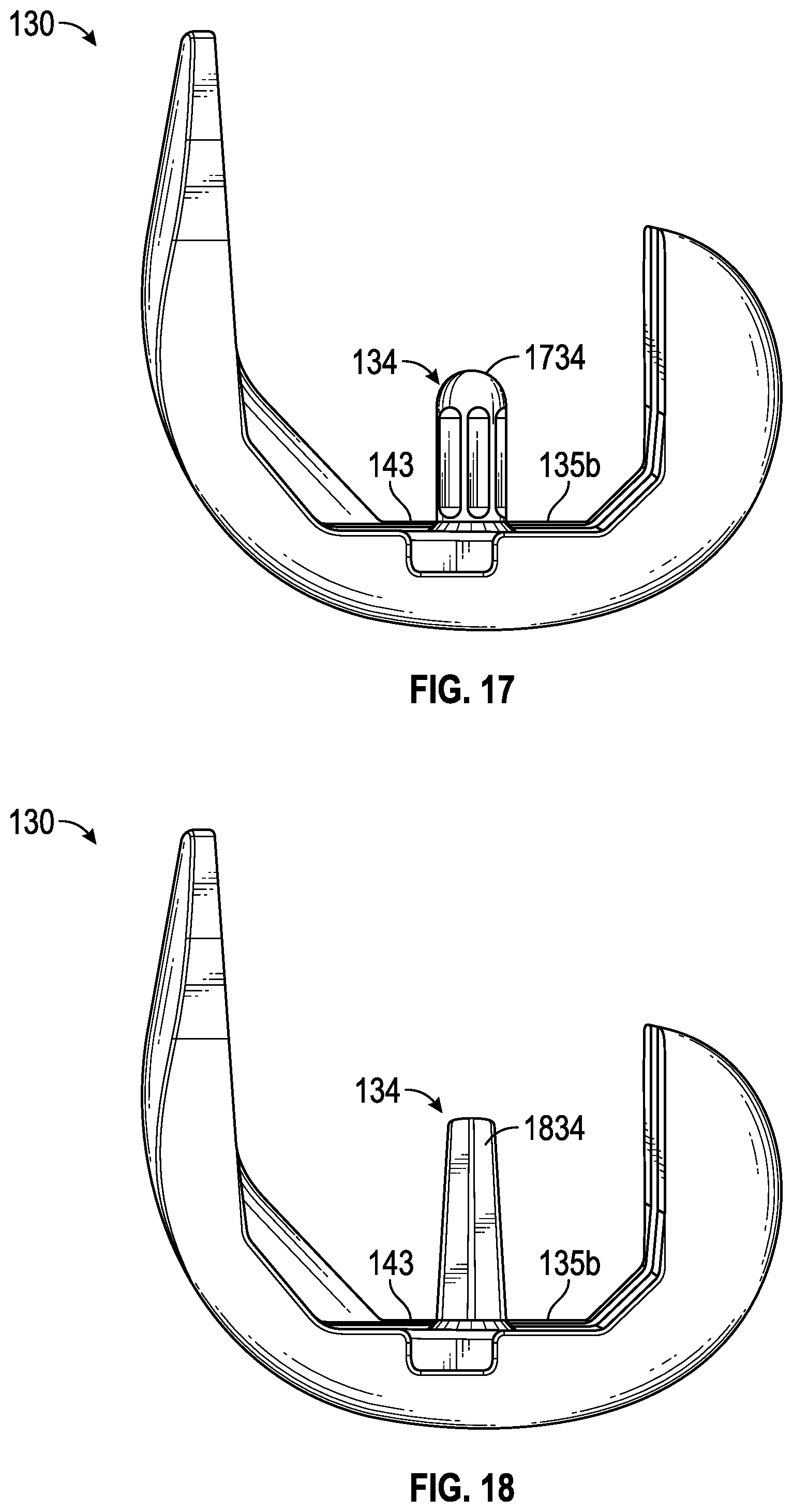 Patent US11793649 Figure 17 – Femoral component for bone conservation