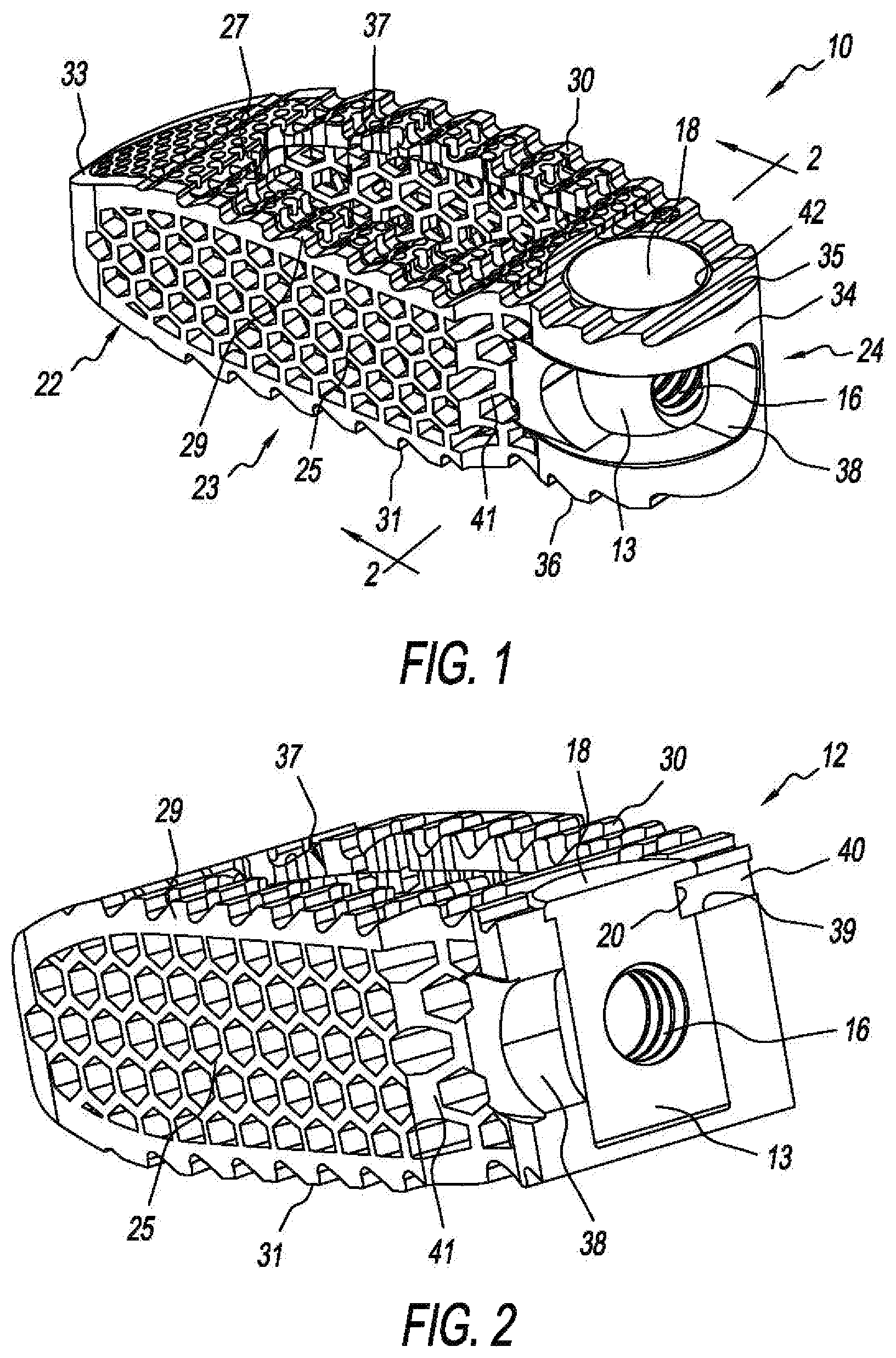 Patent US11793655 — Steerable spine implants — Figure 1