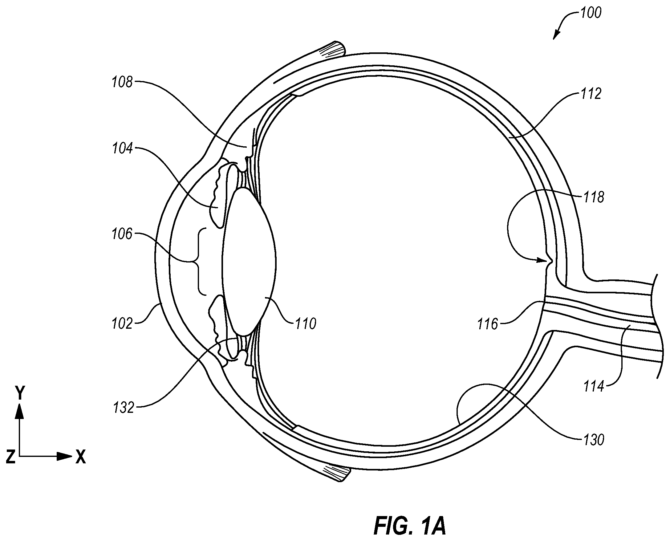 Patent US11793674 — Contact lenses with bifocal characteristics — Figure 1