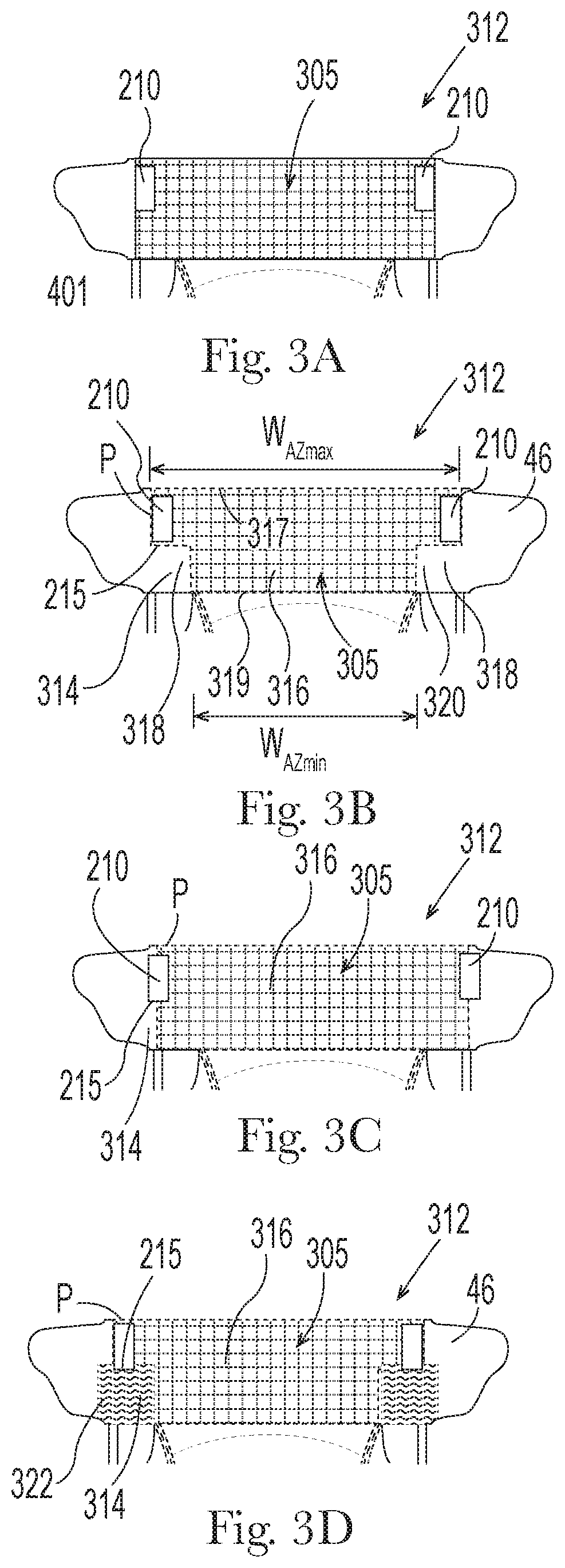 Patent US11793685 Figure 4 – Absorbent article having fastening system