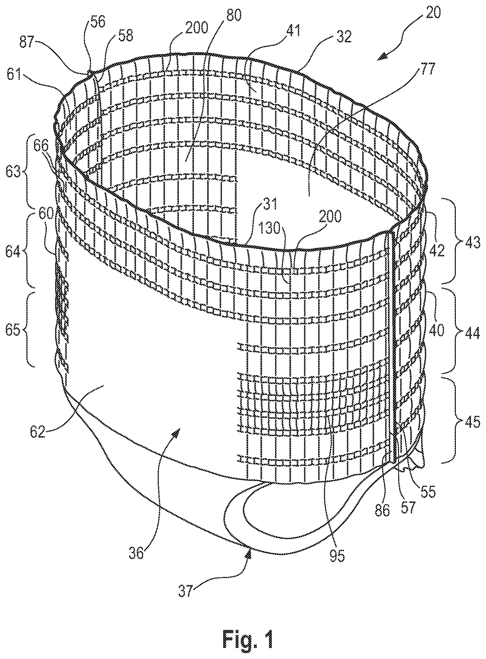 Patent US11793686 — Absorbent article with belt having profiled elasticity — Figure 1