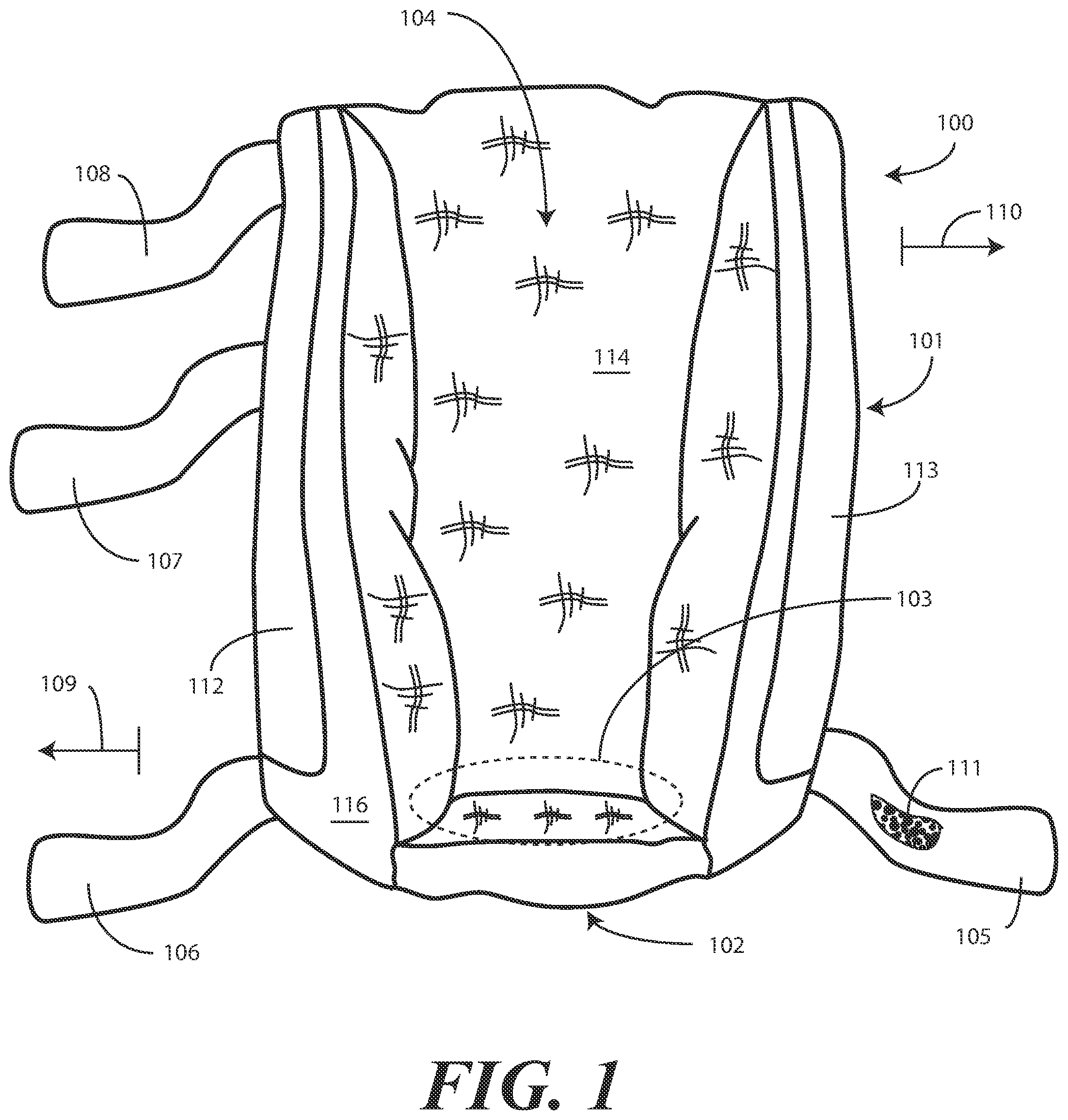 Patent US11793710 — Heel protector and corresponding rehabilitation systems and methods for using the same — Figure 1