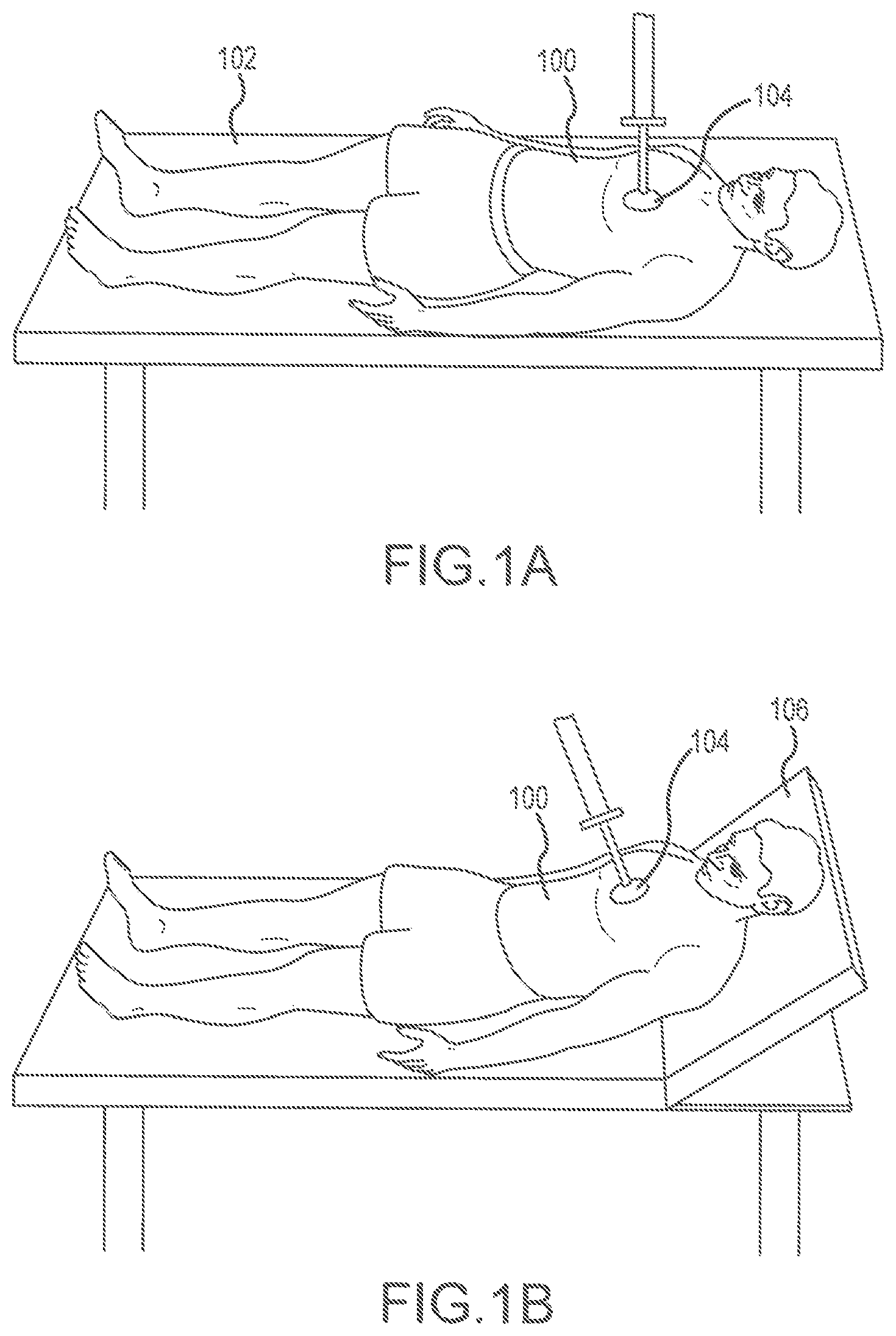 Patent US11793714 — Support devices for head up cardiopulmonary resuscitation — Figure 1