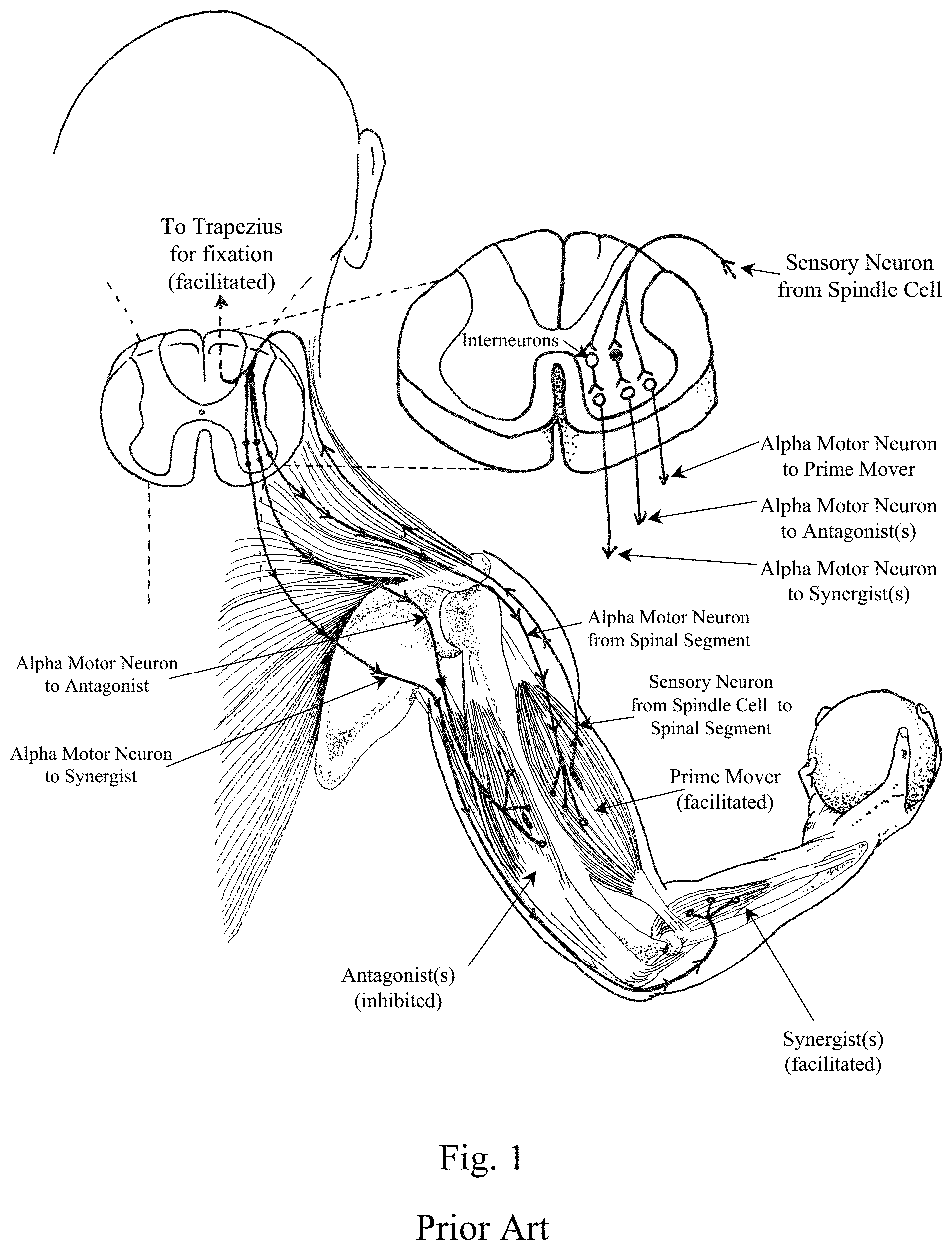 Patent US11793716 — Muscle optimization device and method — Figure 1