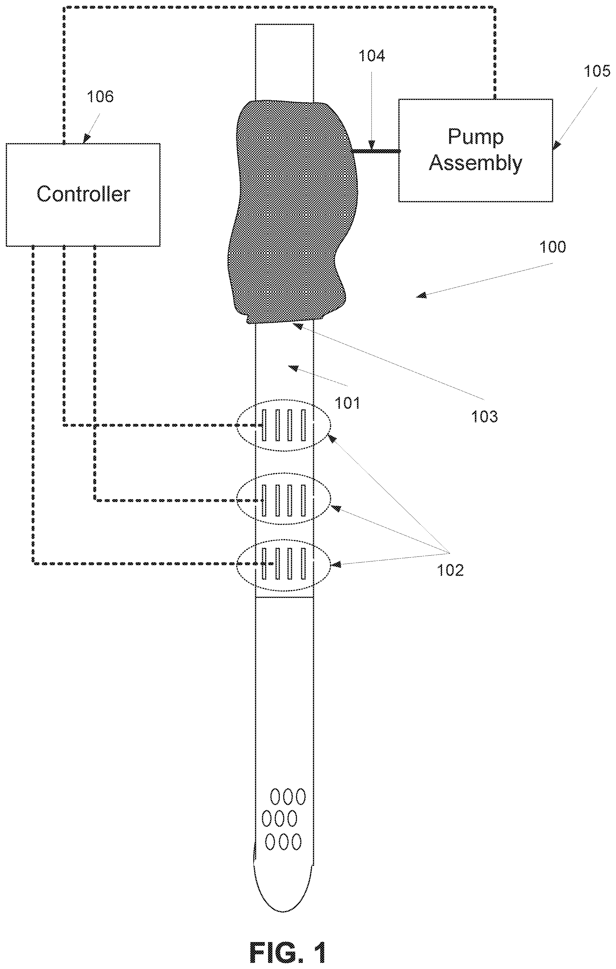 Patent US11793728 — Method and device of detecting and/or blocking reflux — Figure 1