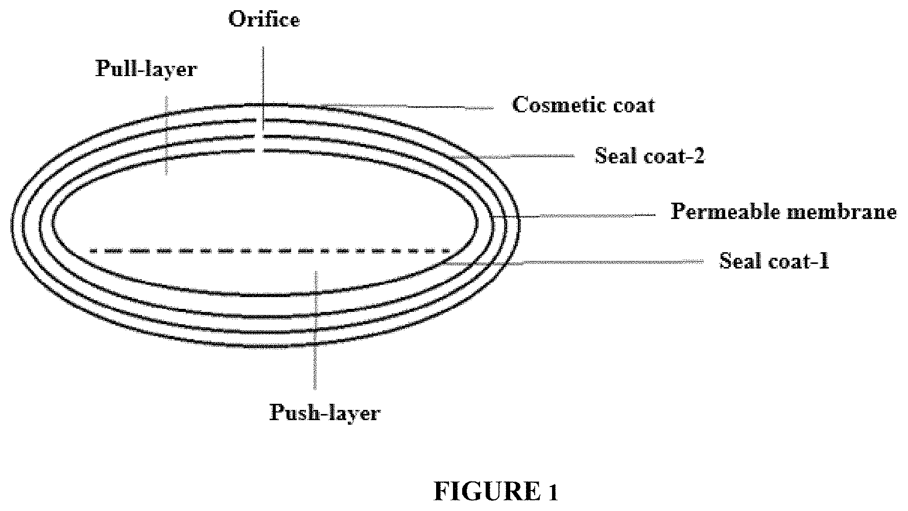 Patent US11793747 — Self-regulating osmotic gastroretentive drug delivery systems — Figure 1