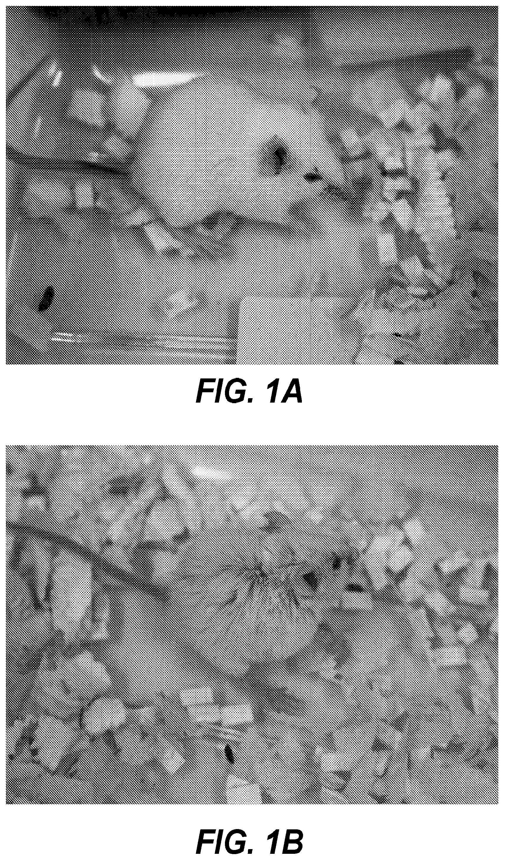 Patent US11793782 — Therapeutic agents for neurodegenerative diseases — Figure 1