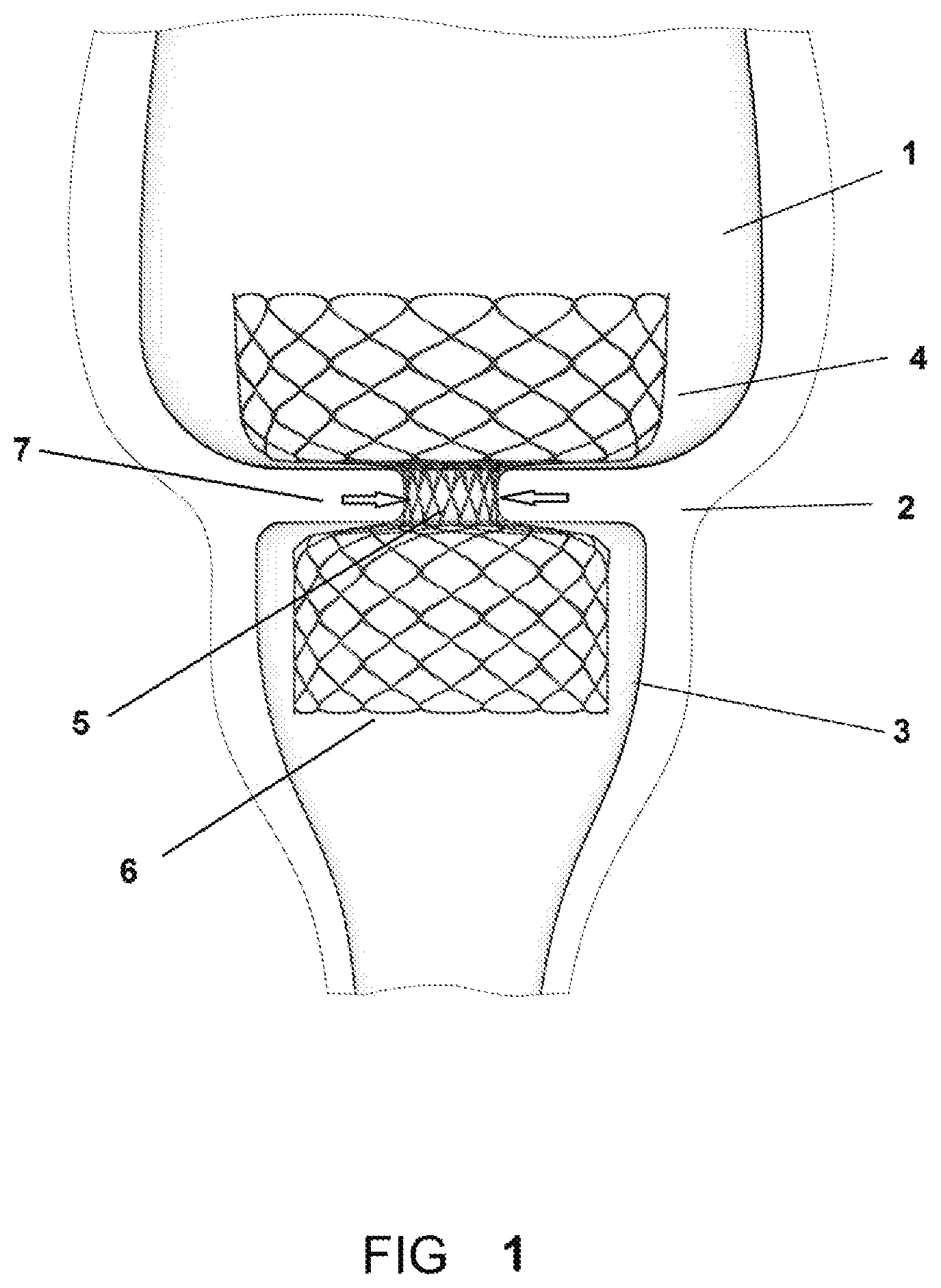 Patent US11793839 — System and method for affecting intestinal microbial flora — Figure 1