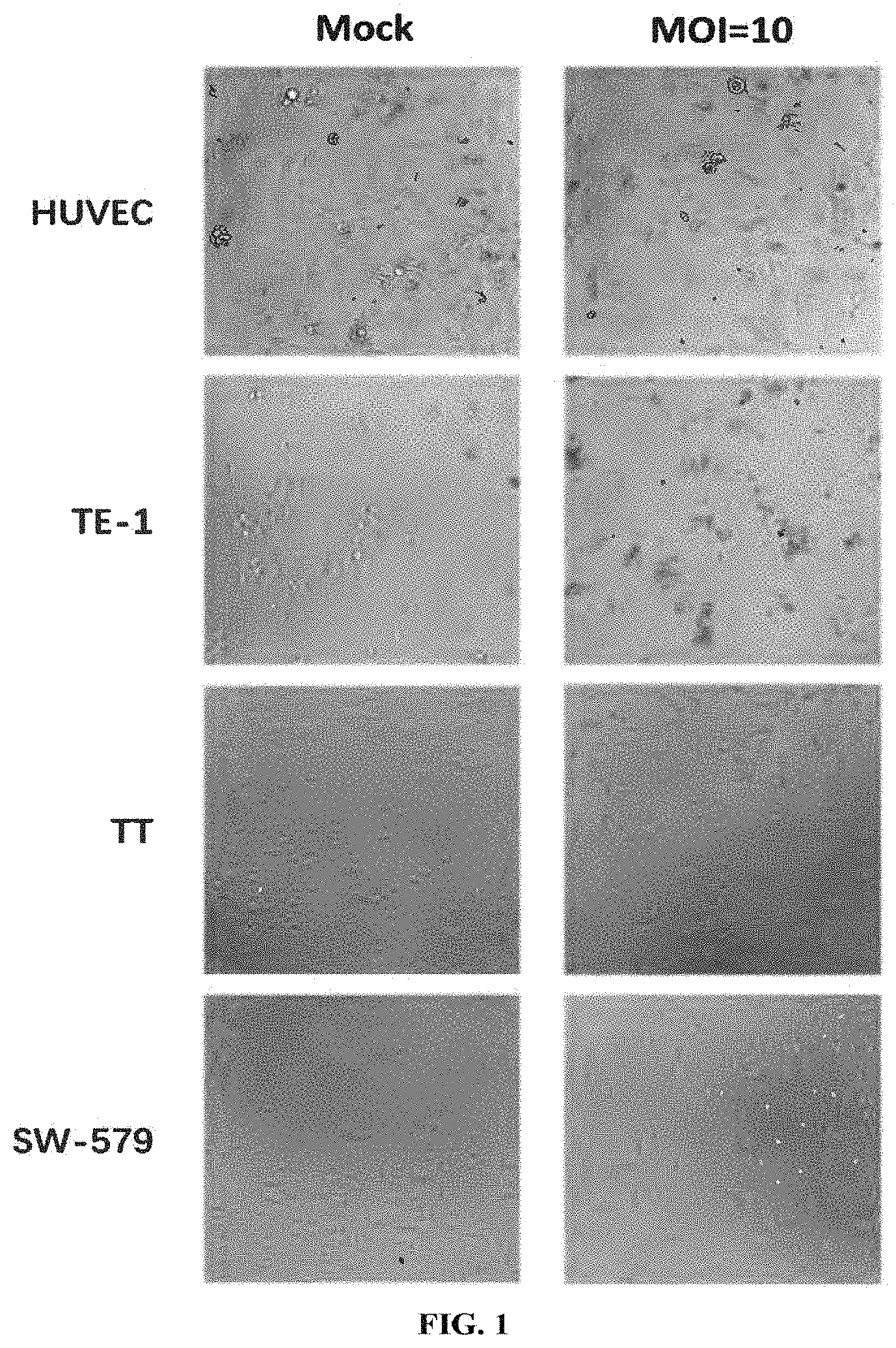 Patent US11793844 Figure 1 – Virus for treatment of tumor